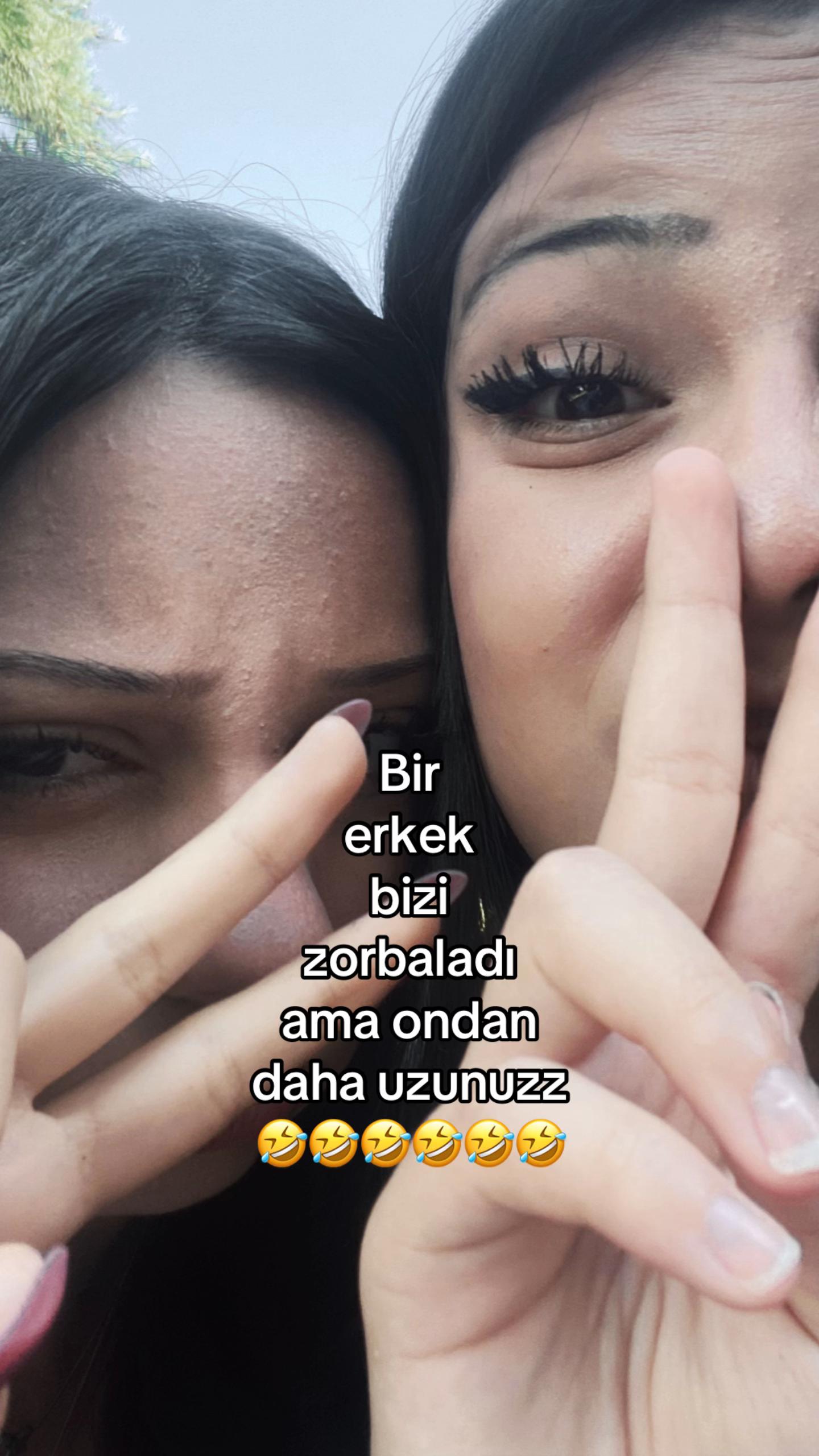 @CHERRY COLA🇹🇷