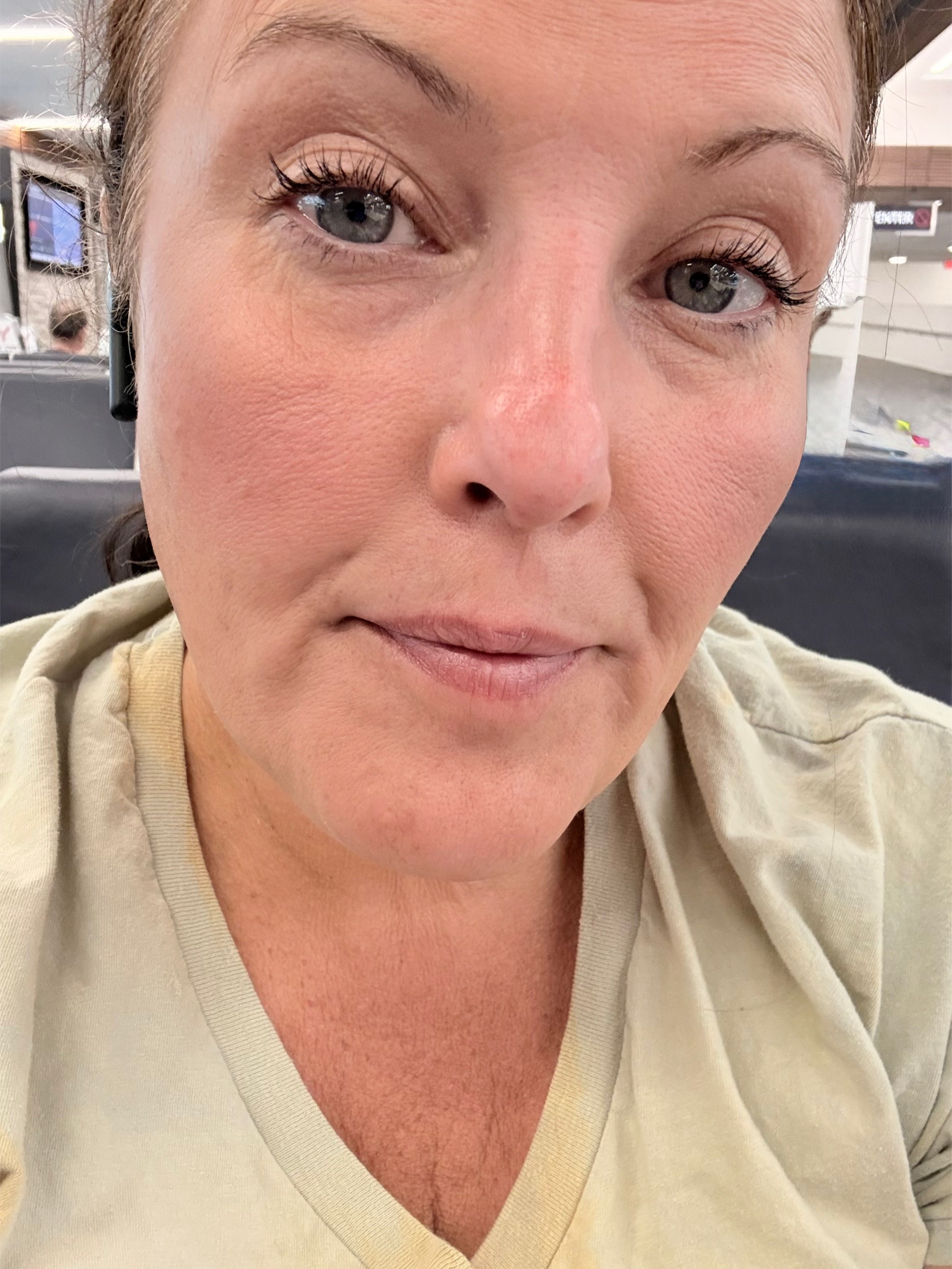 @Lifewithavnsurviving