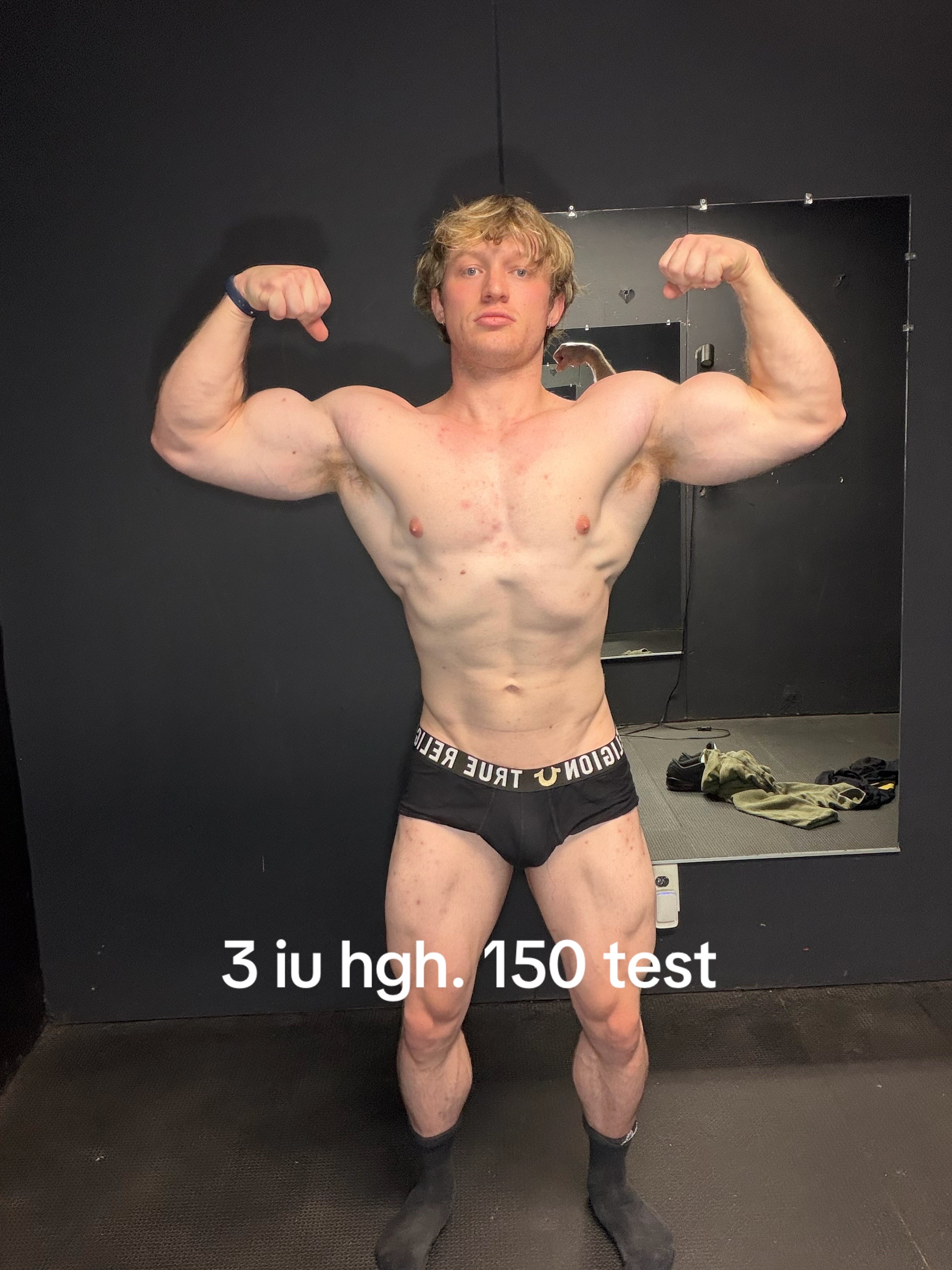@NattySux