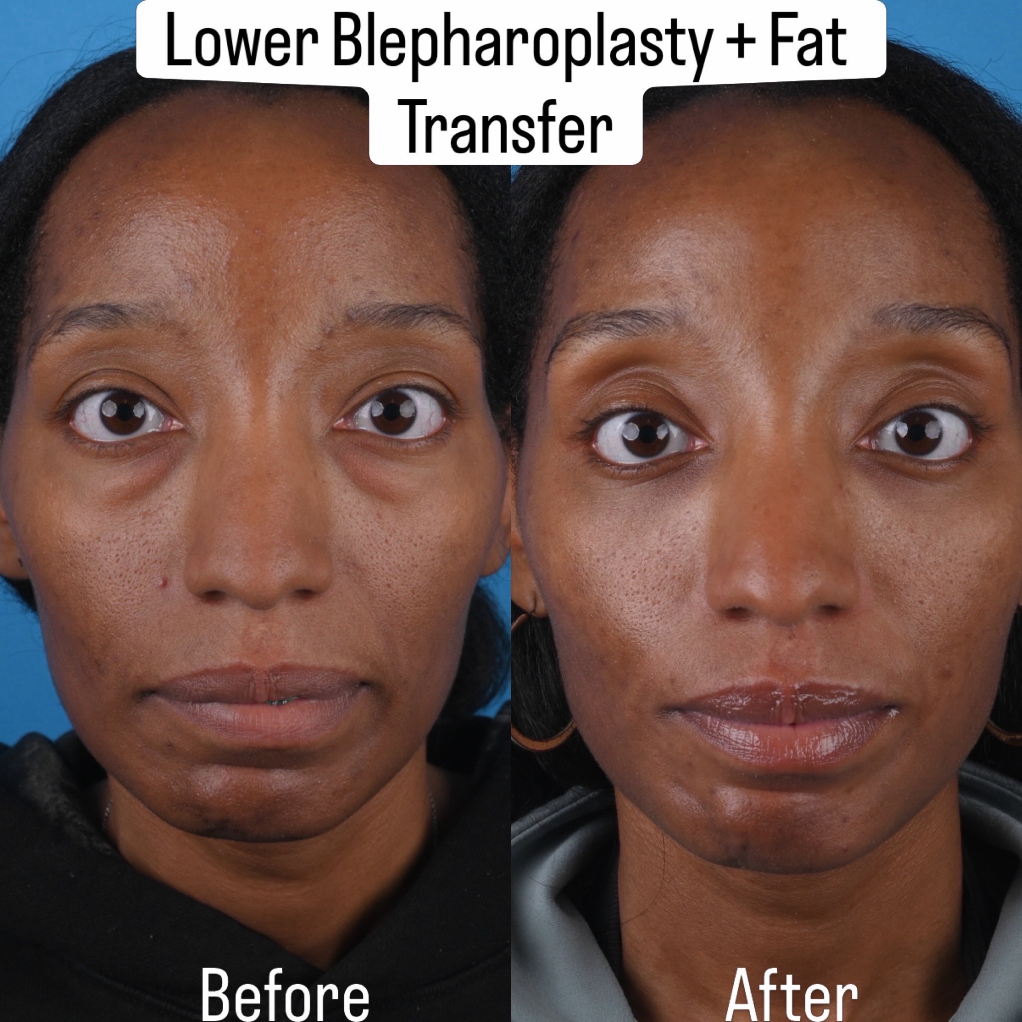 @Dr. Parit Patel, MD