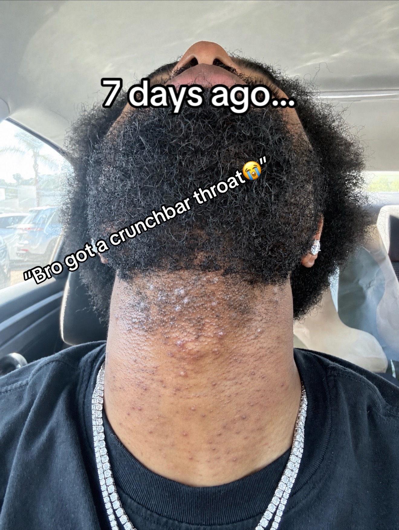 @Imtredarius