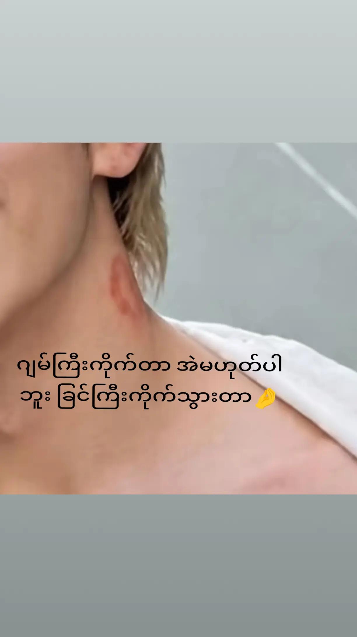 @ð¹MMTð¹á¥«á¡ 4.1M ᥫá¡