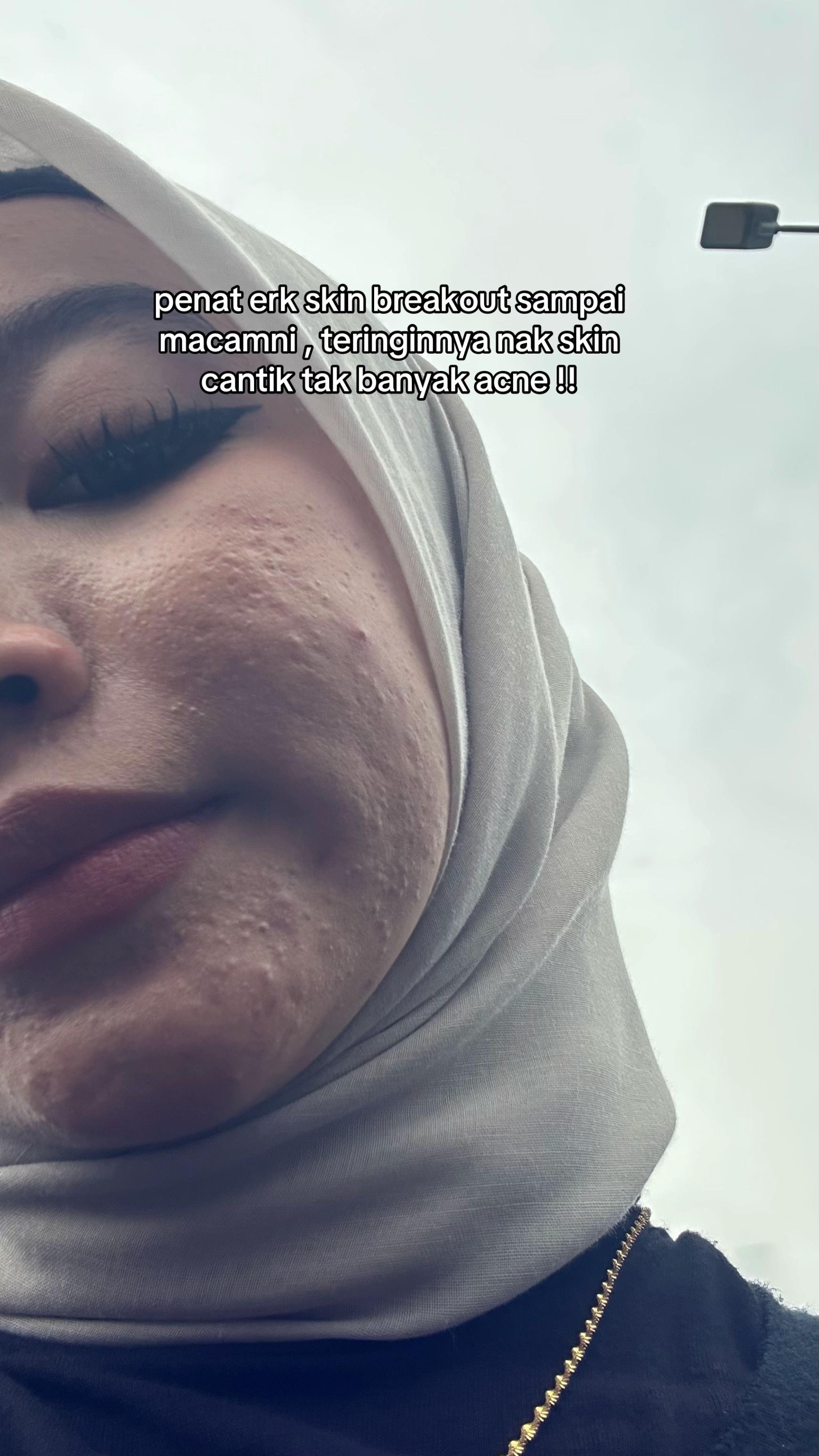 @M