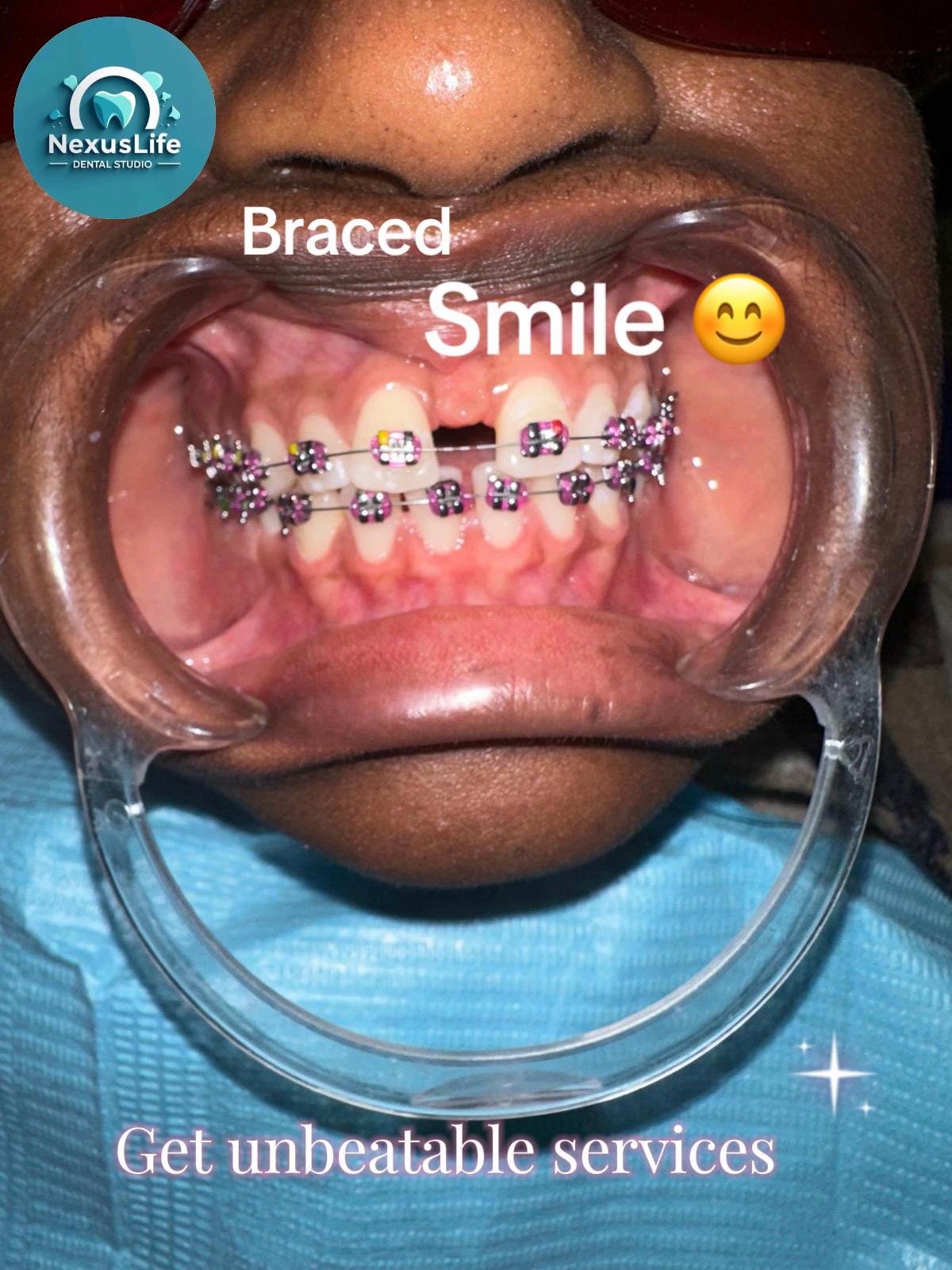 @NEXUSLIFE DENTAL CLINIC🦷
