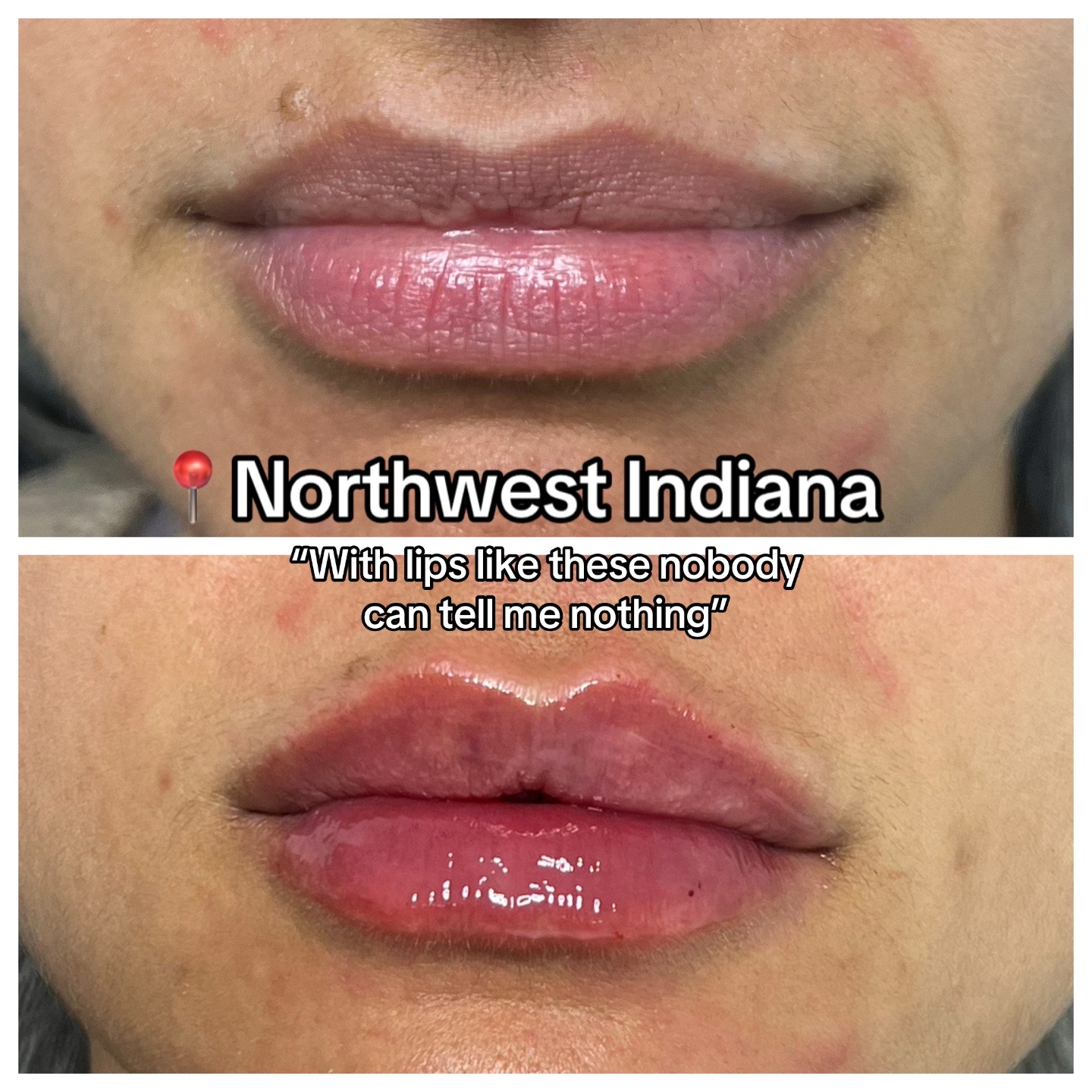 @Christy - NWI Aesthetic NP
