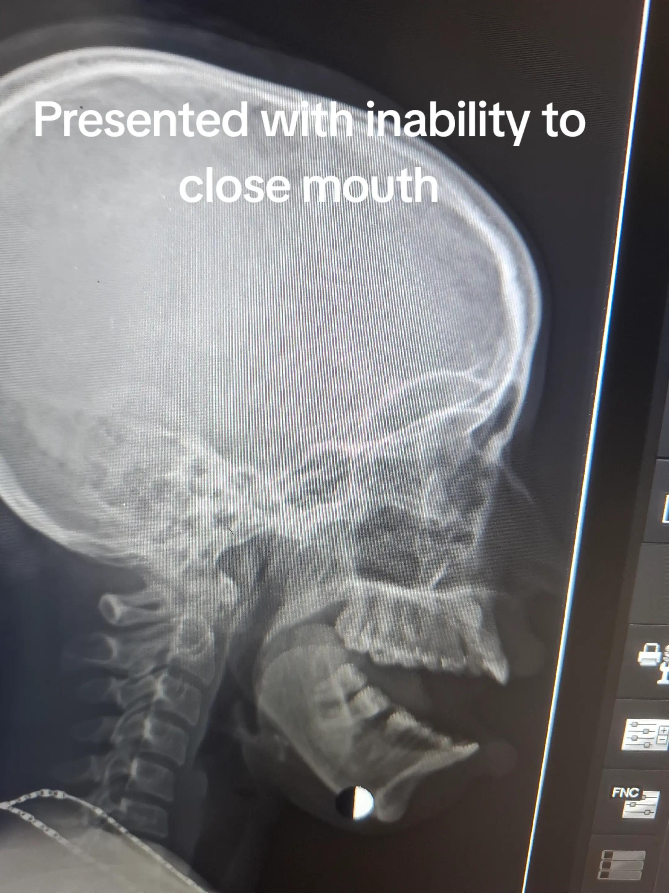 @Dr Wubie Endalew(Radiologist)