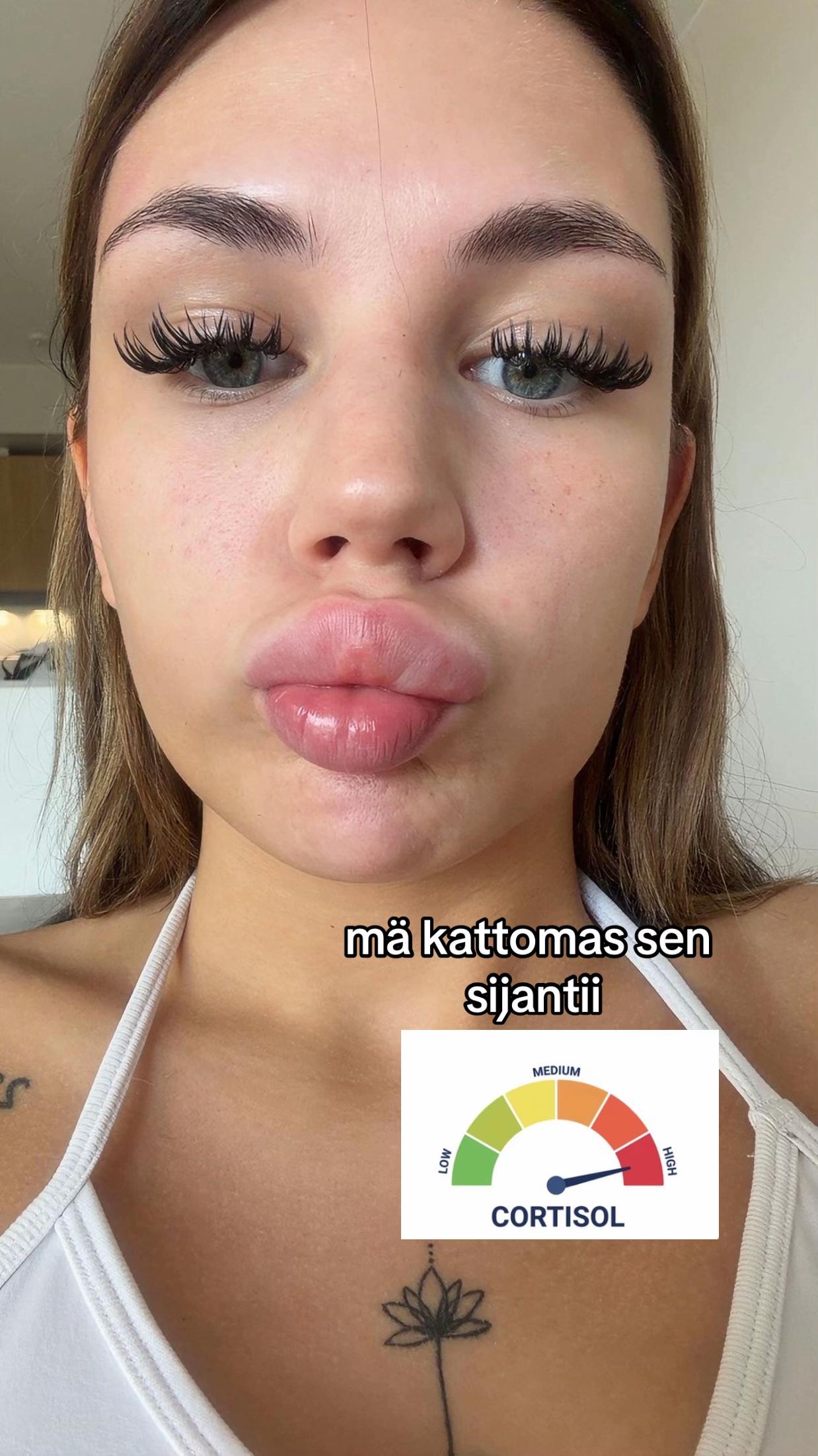 @carlaawa