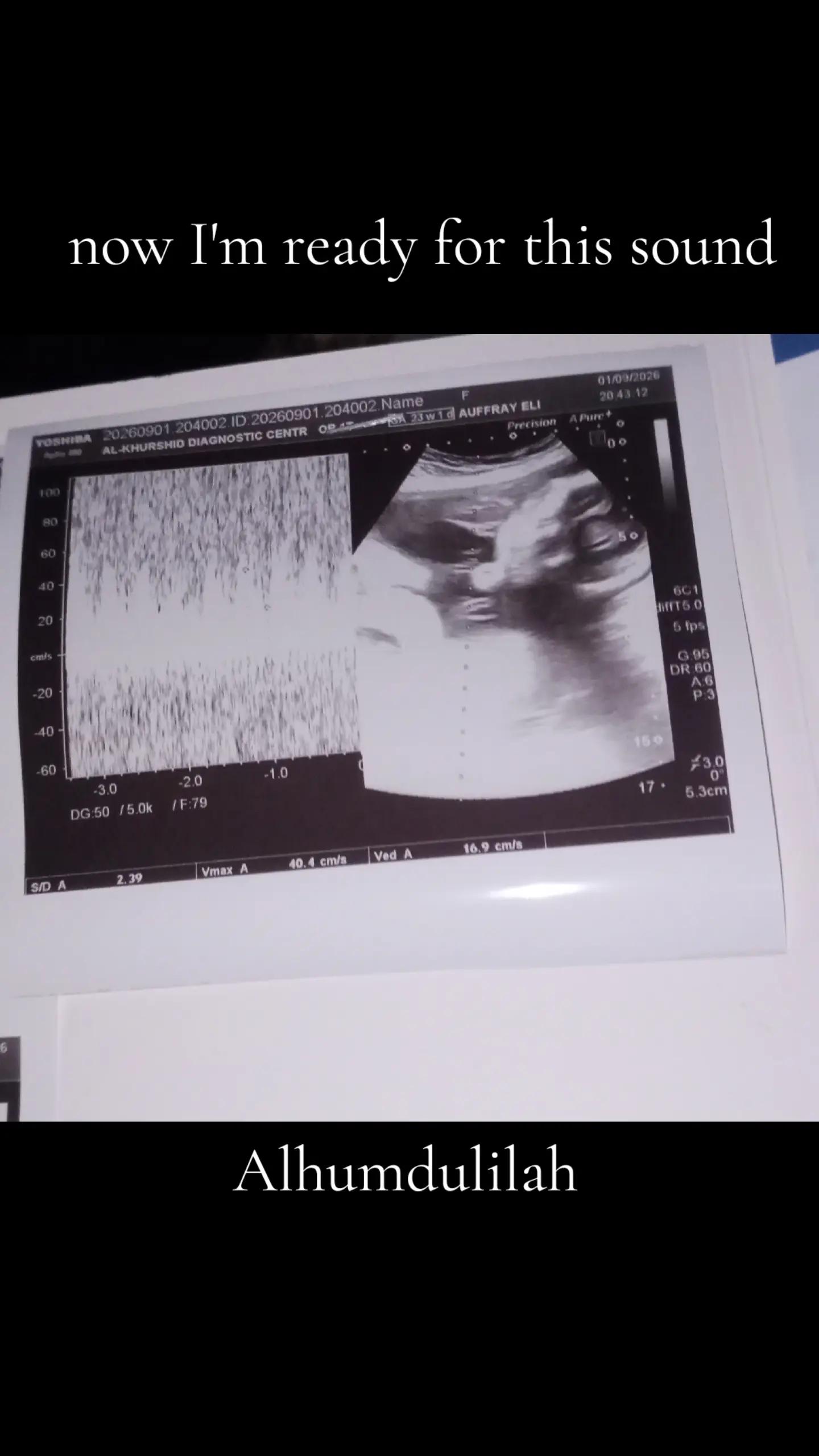 @Mommy to be