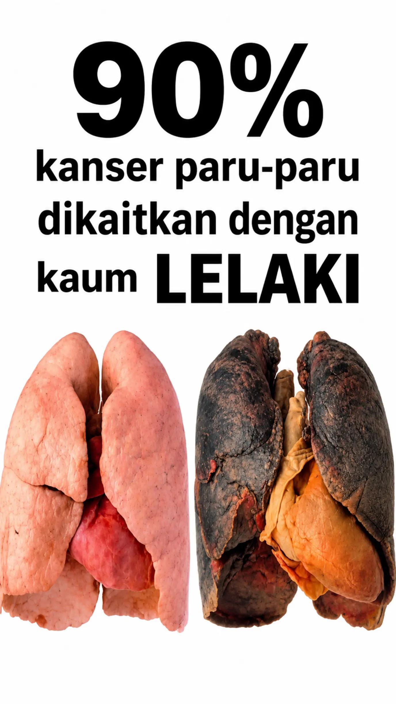 @Hida Rani