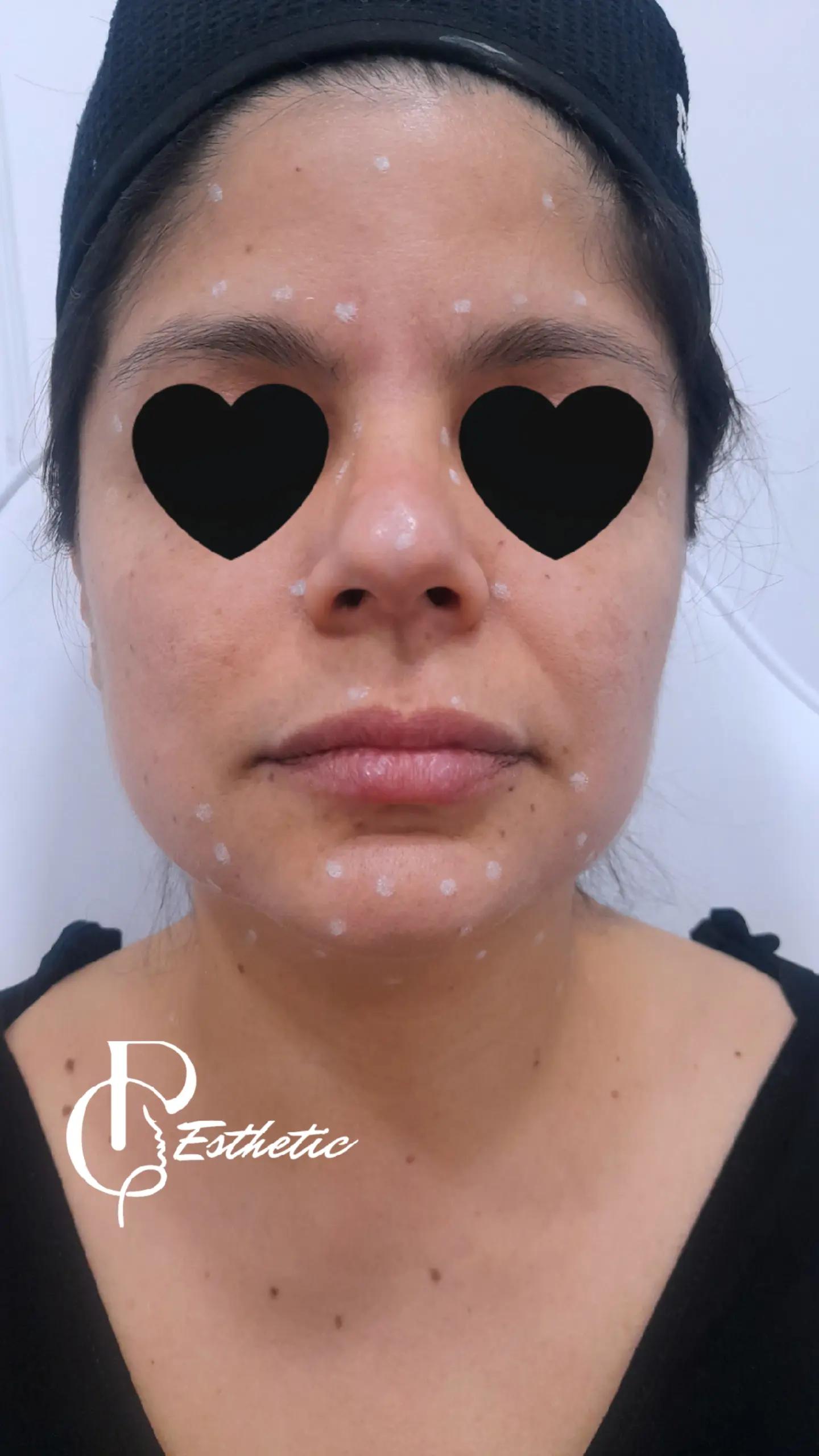 @Medicina Est&eacute;tica y Avanzada
