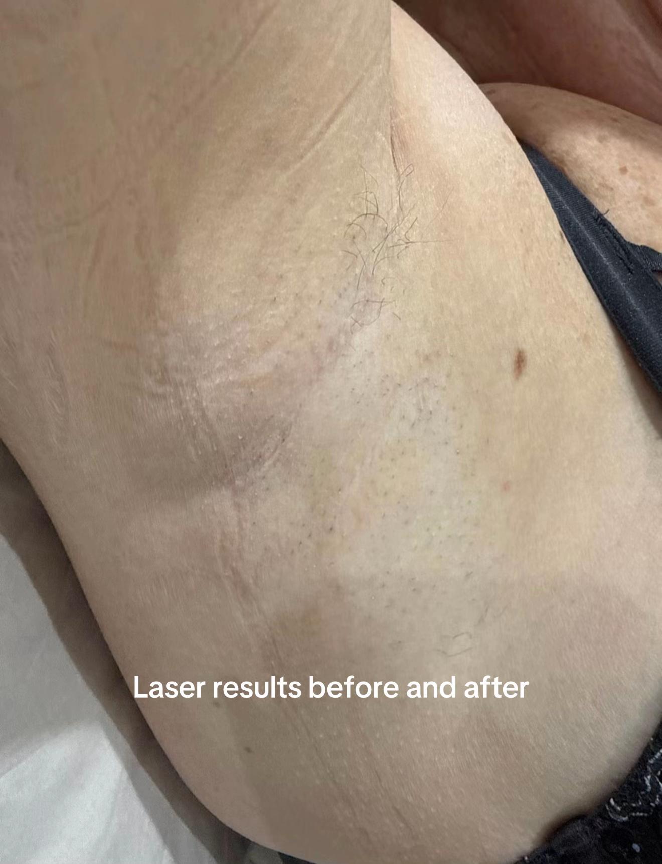 @laserloungemcr