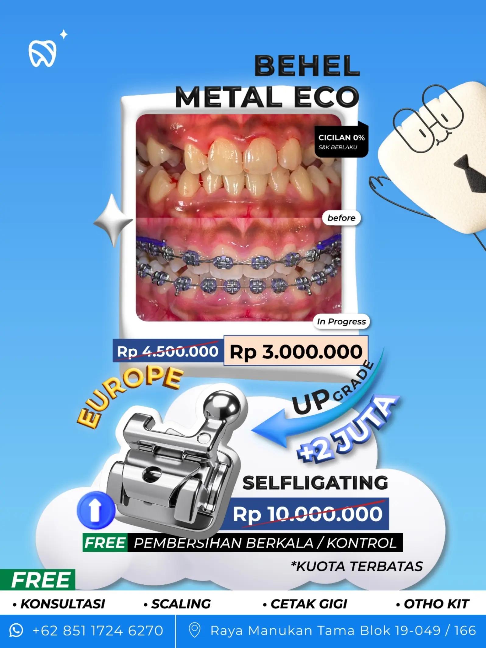 @Dentine Plus
