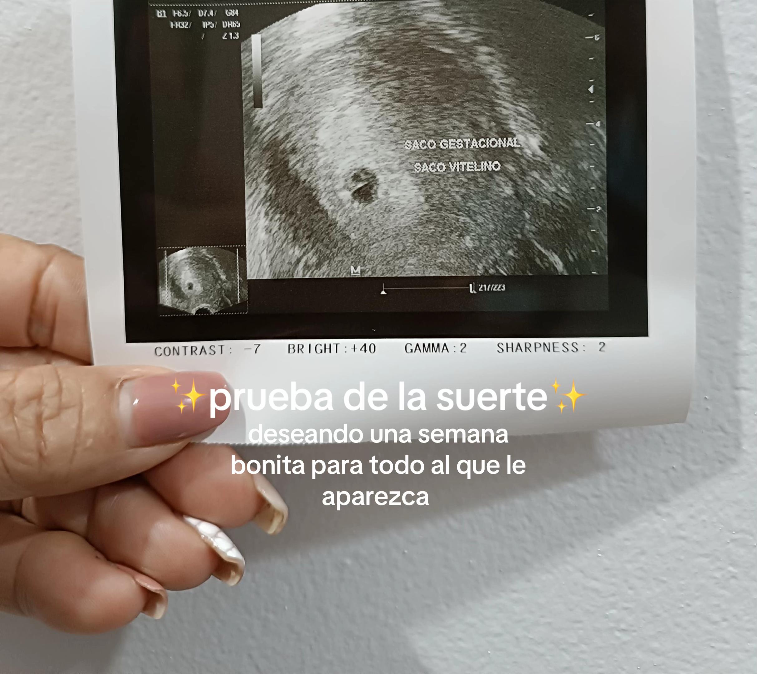 @Cevalfes