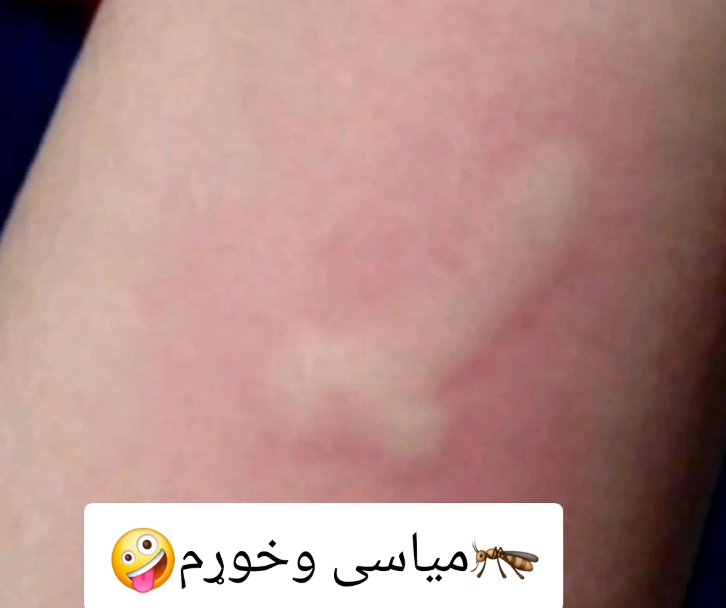 @funny video🤣😂