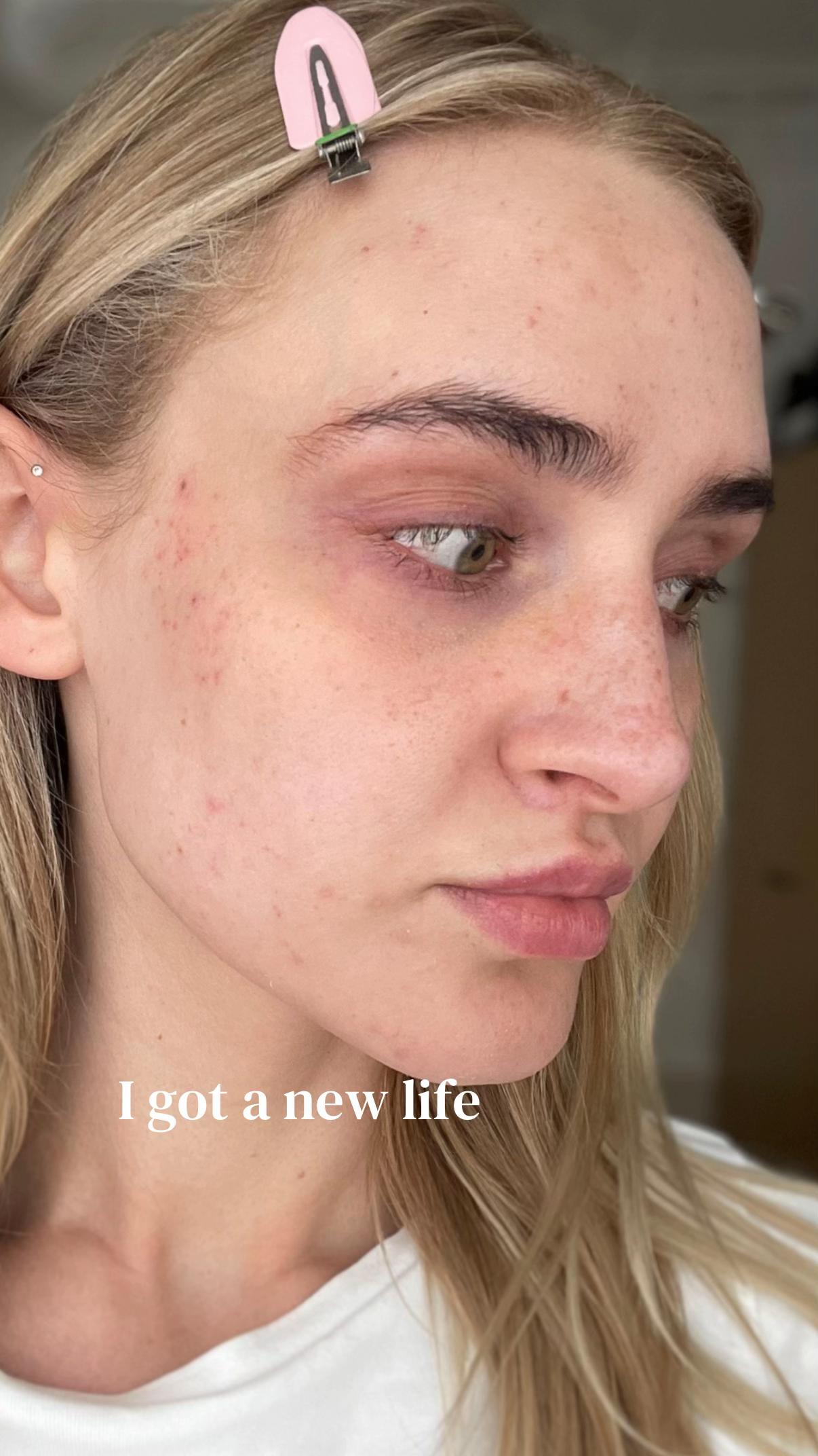@ANNI BRØNNING