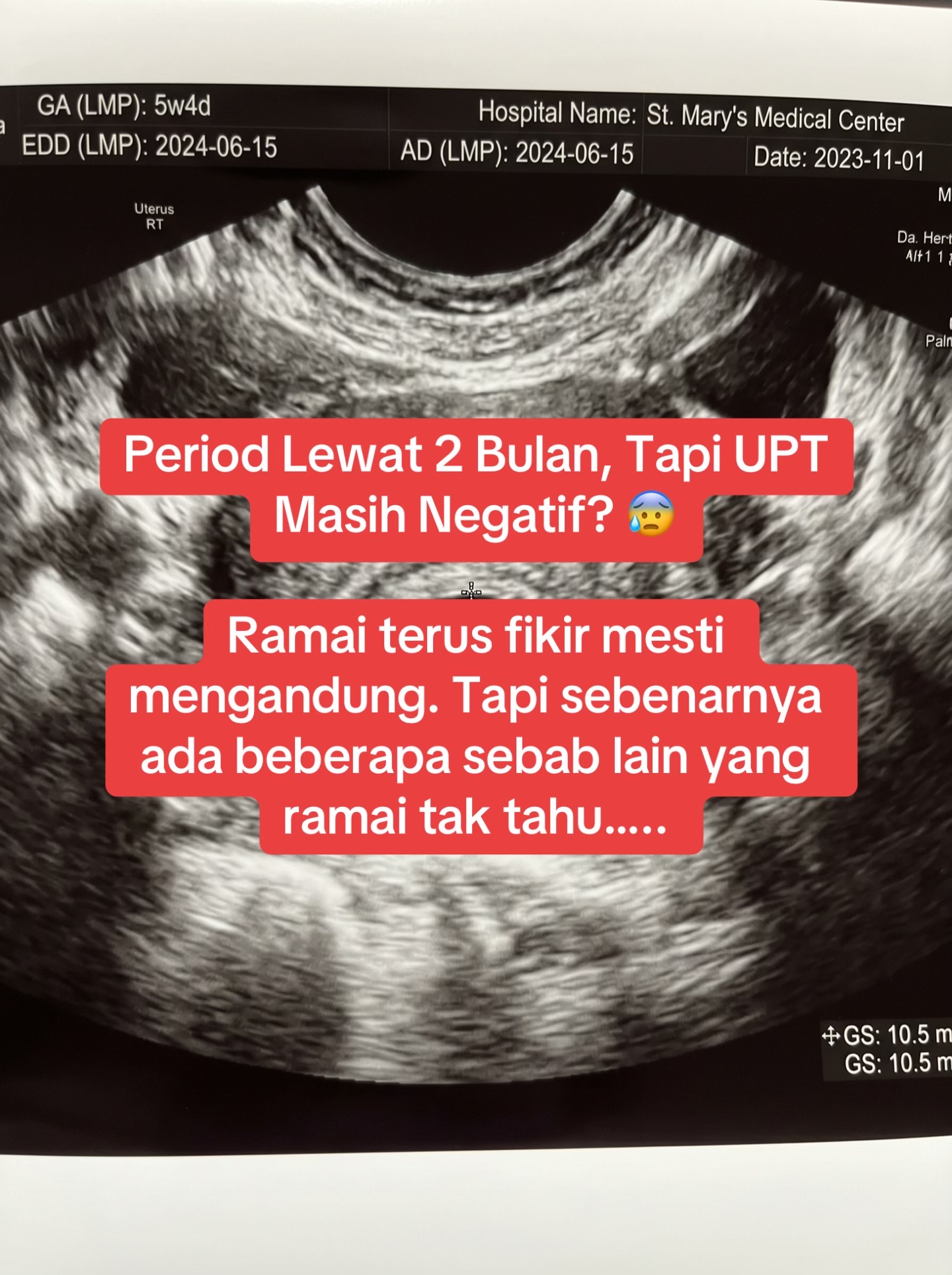 @effertymy