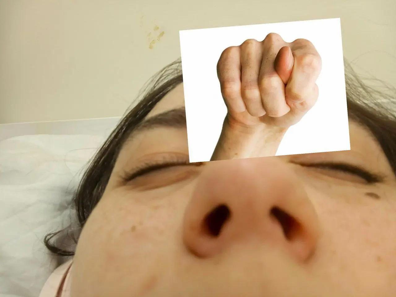 @dew