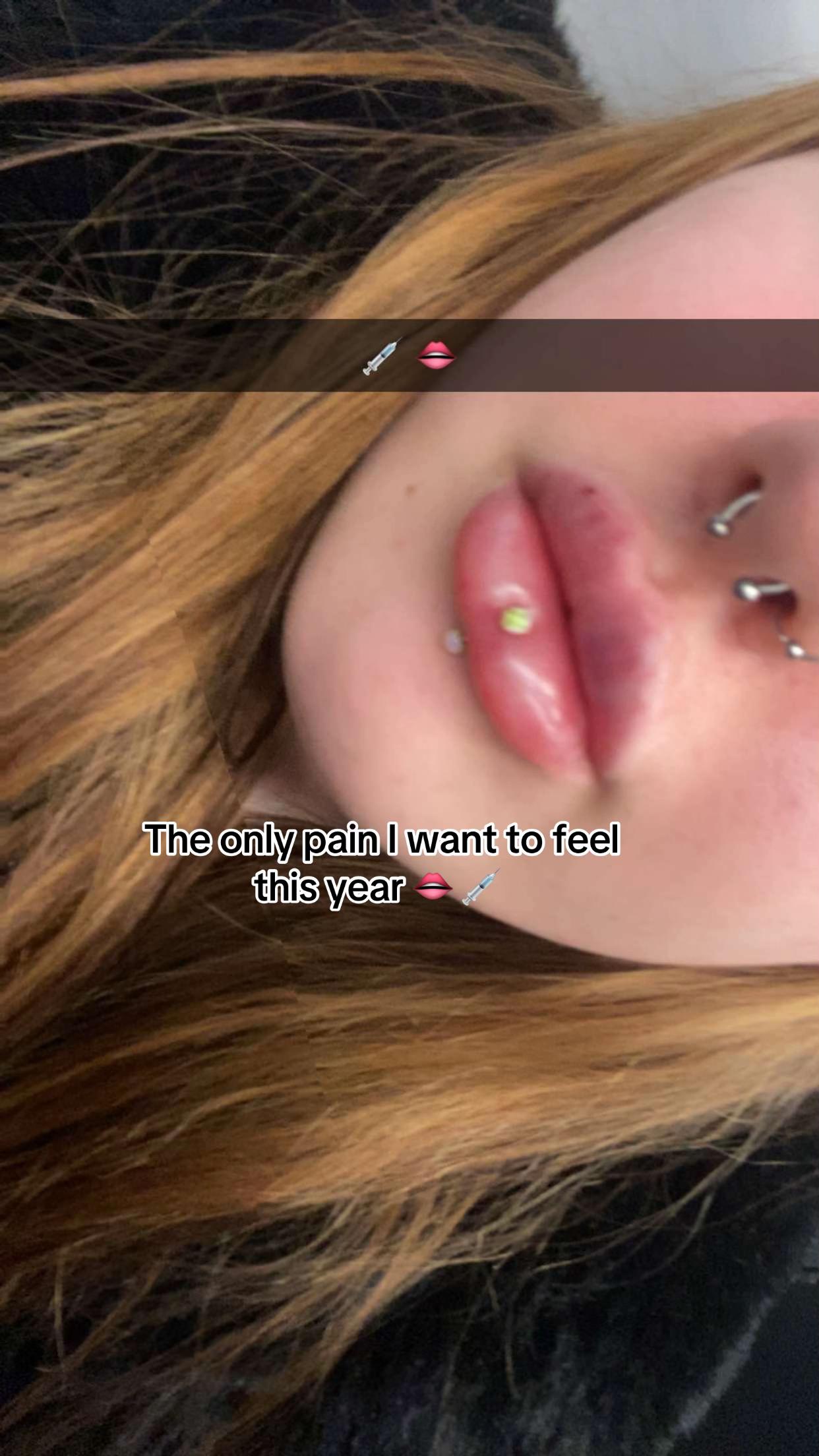 @Unknown44x