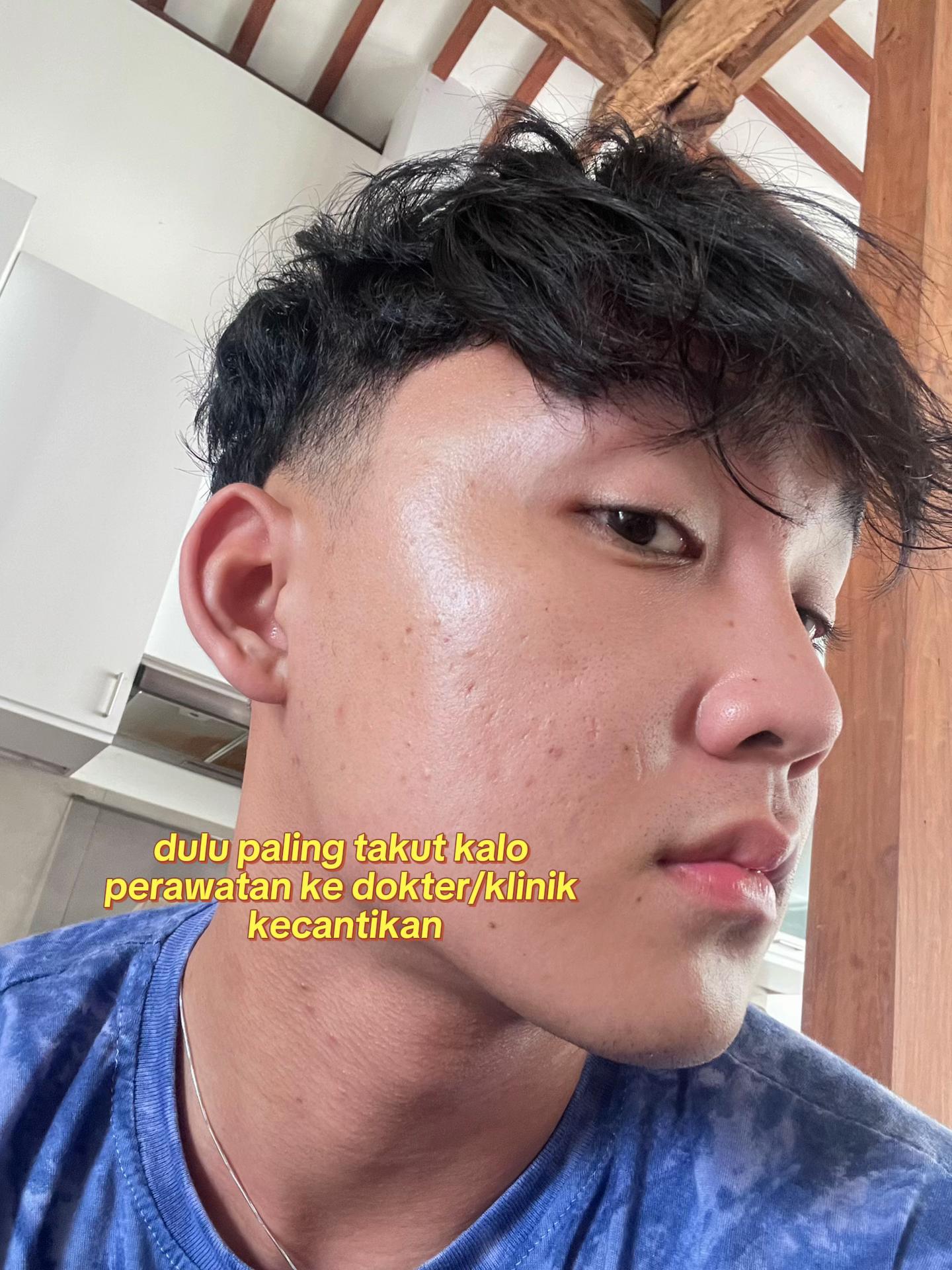 @neplinn