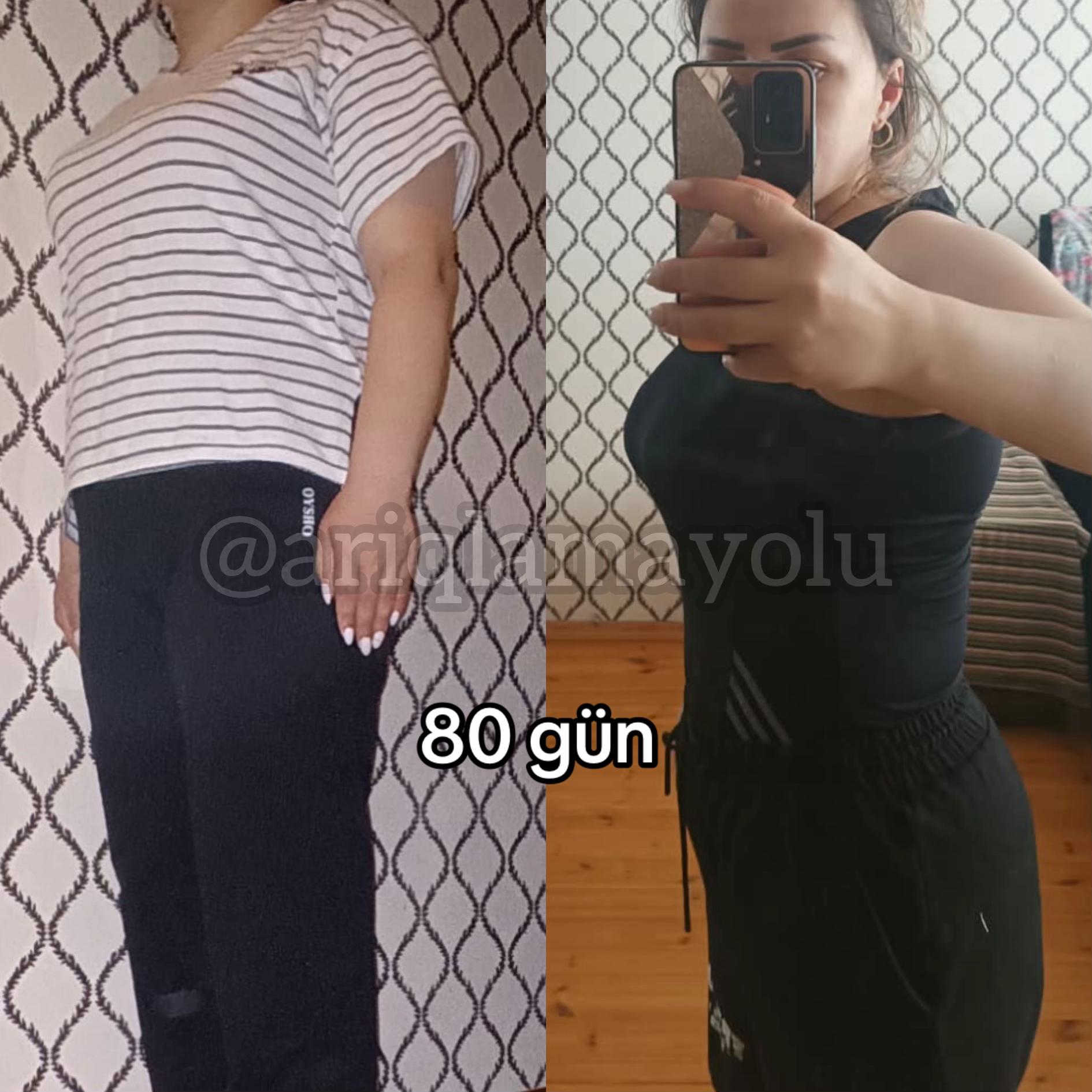 @Nutrisioloq Nilay Camalova 🥑