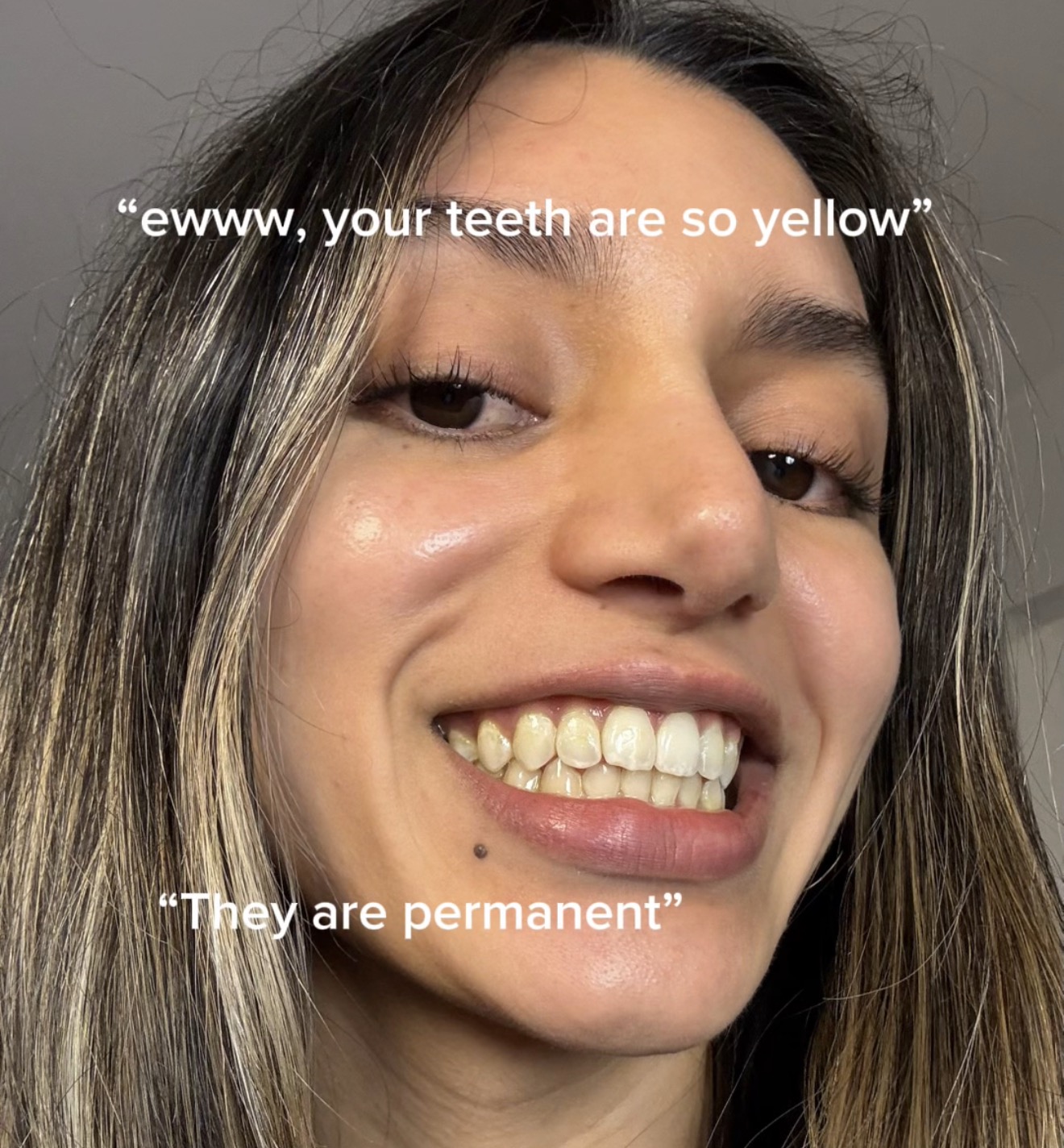 @Bella