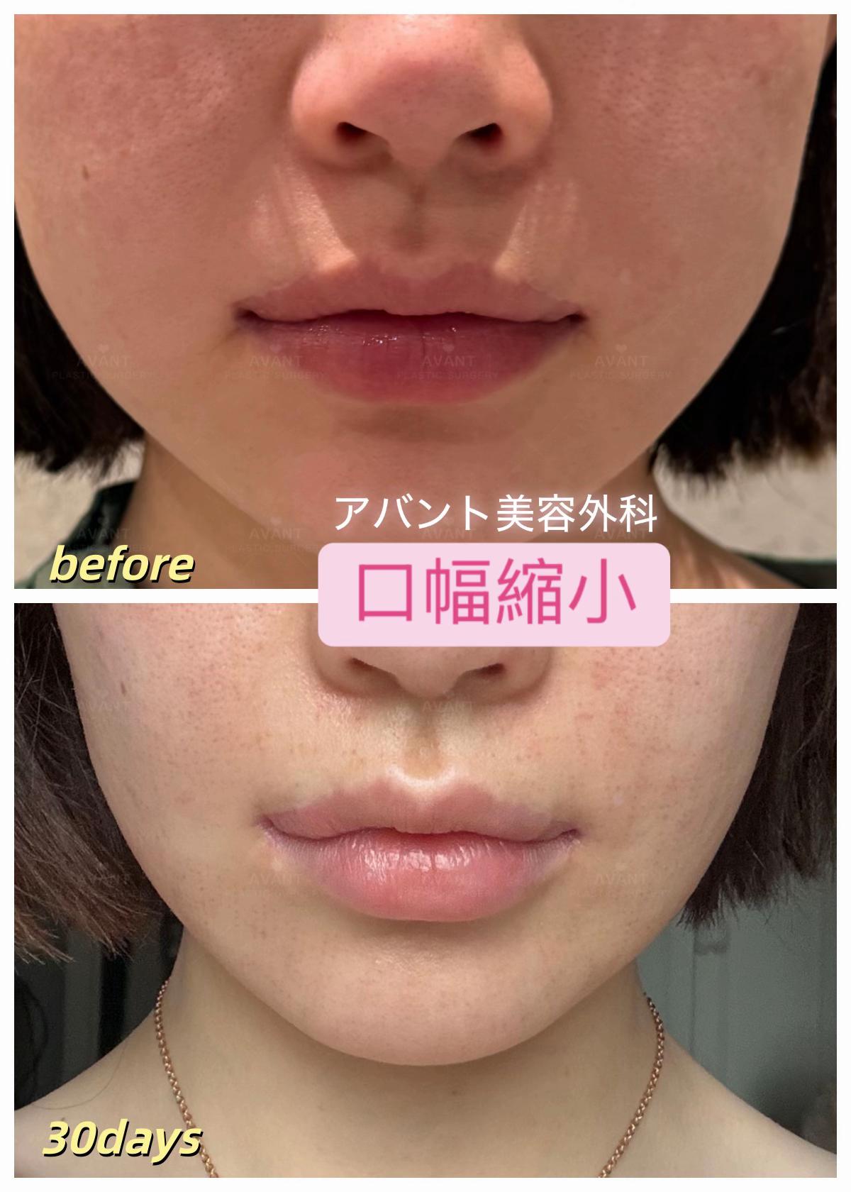 @Avant美容外科