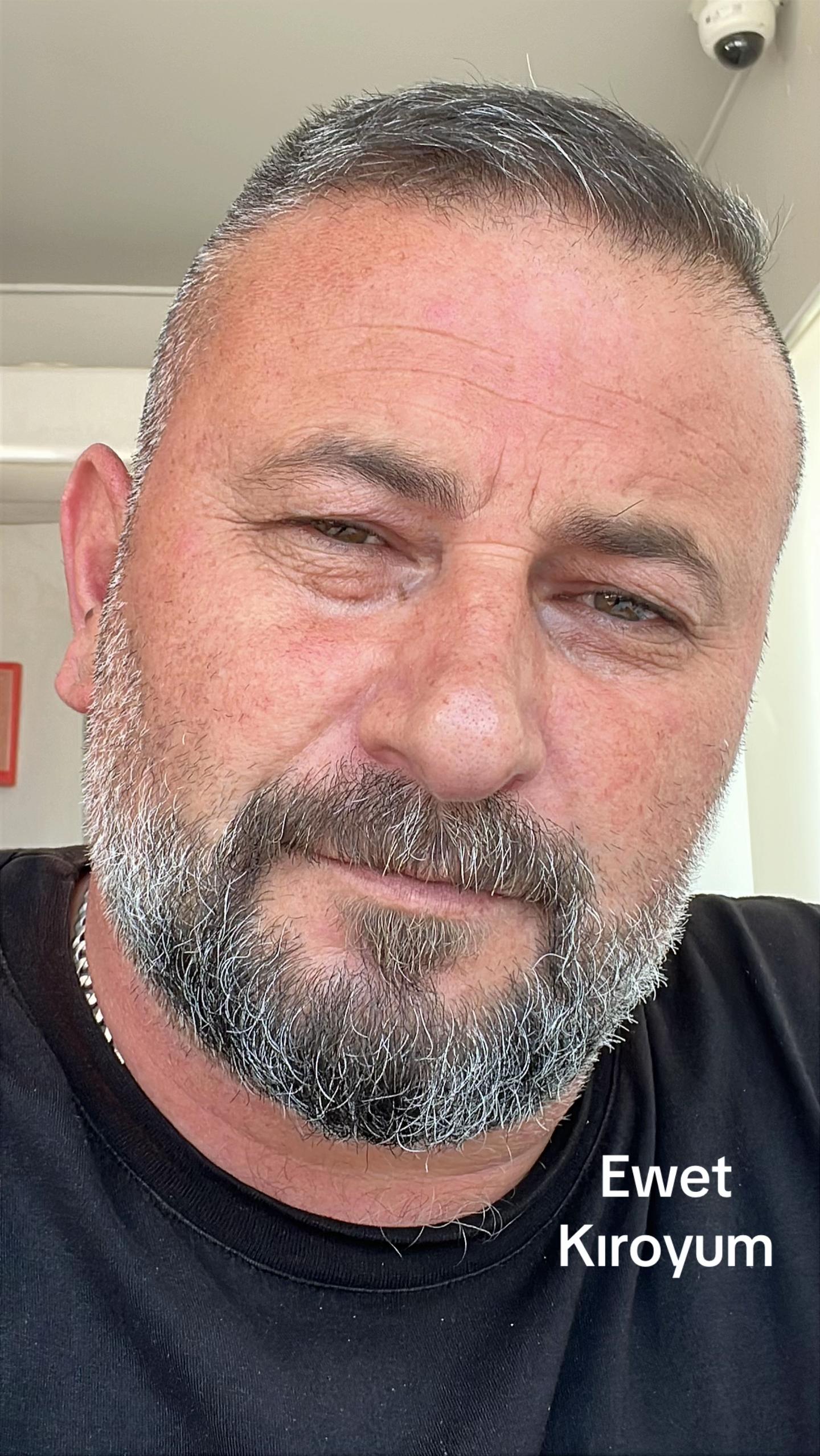 @Azer Nihat
