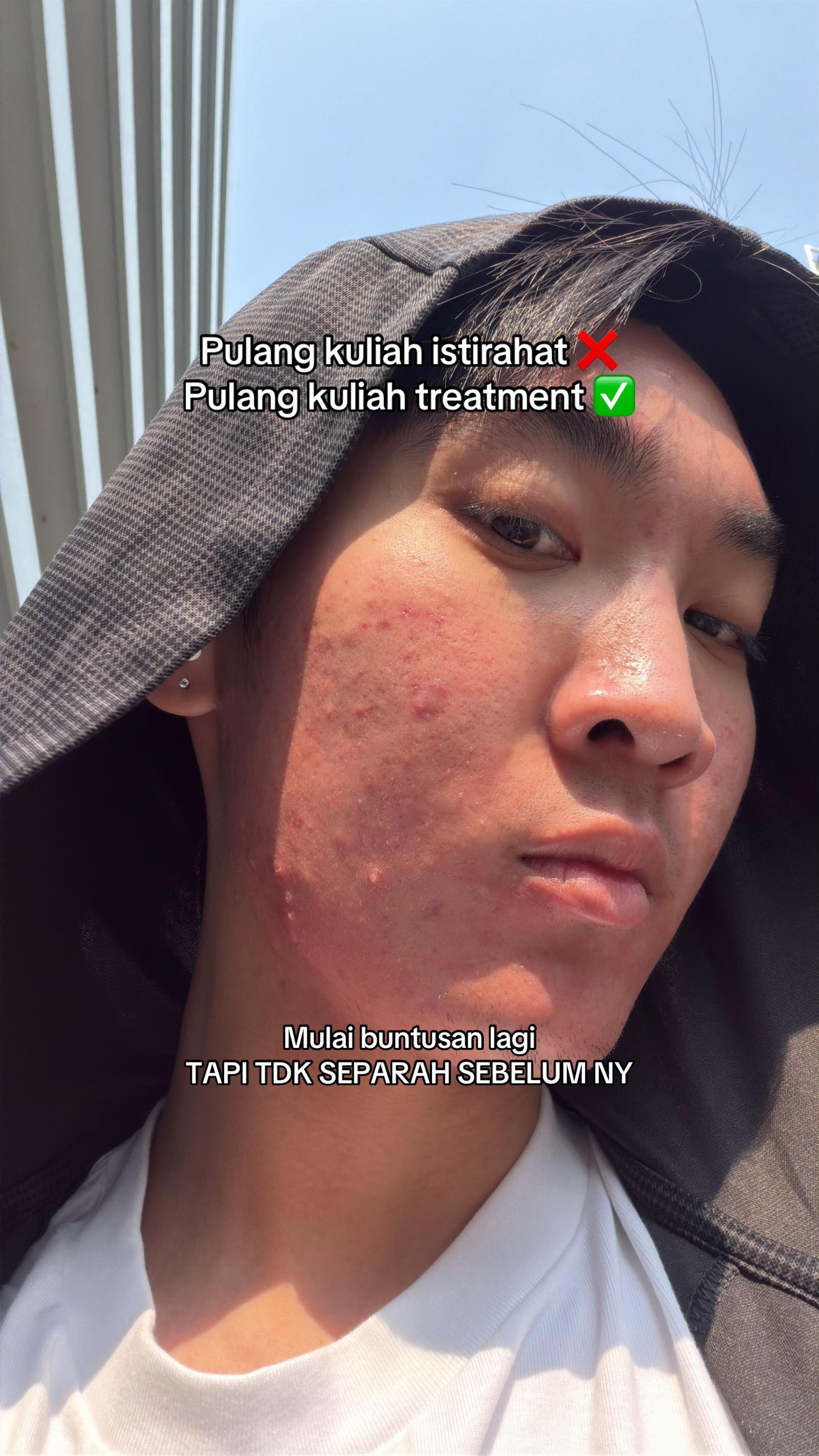 @Mau kulit sehat