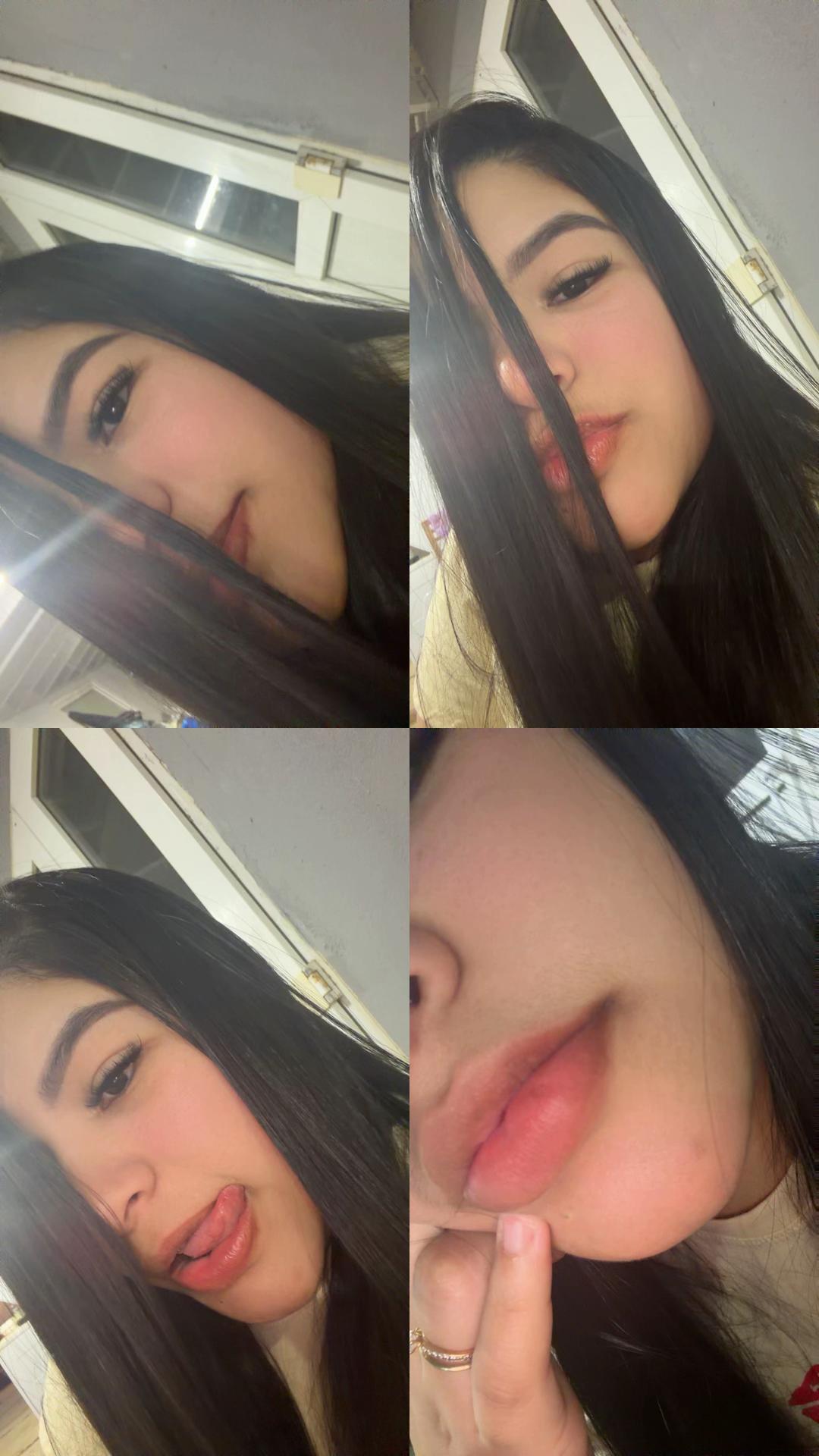 @Yaidilin Leidenz