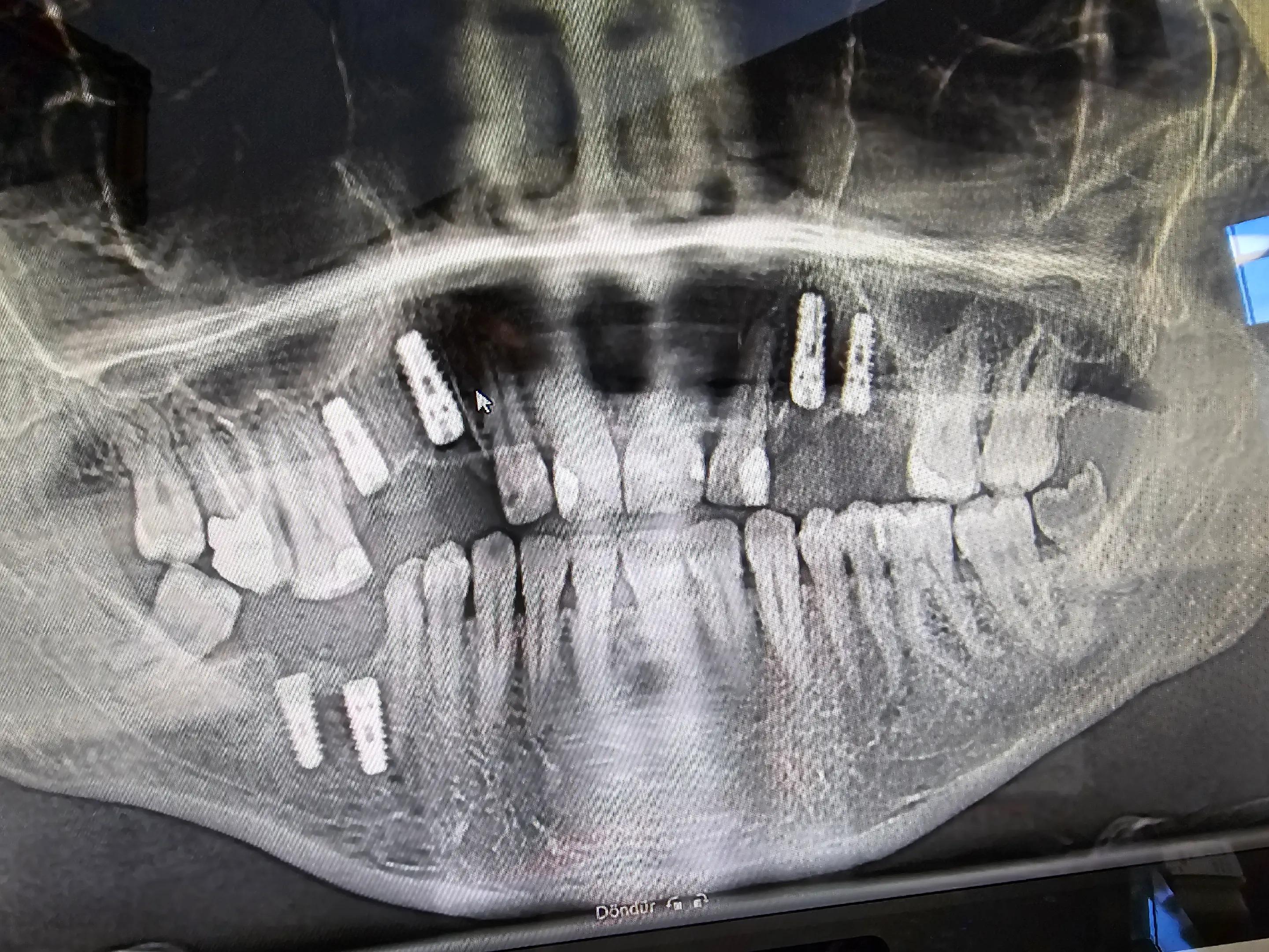 @DişHekimi Fikret Altan Dentist