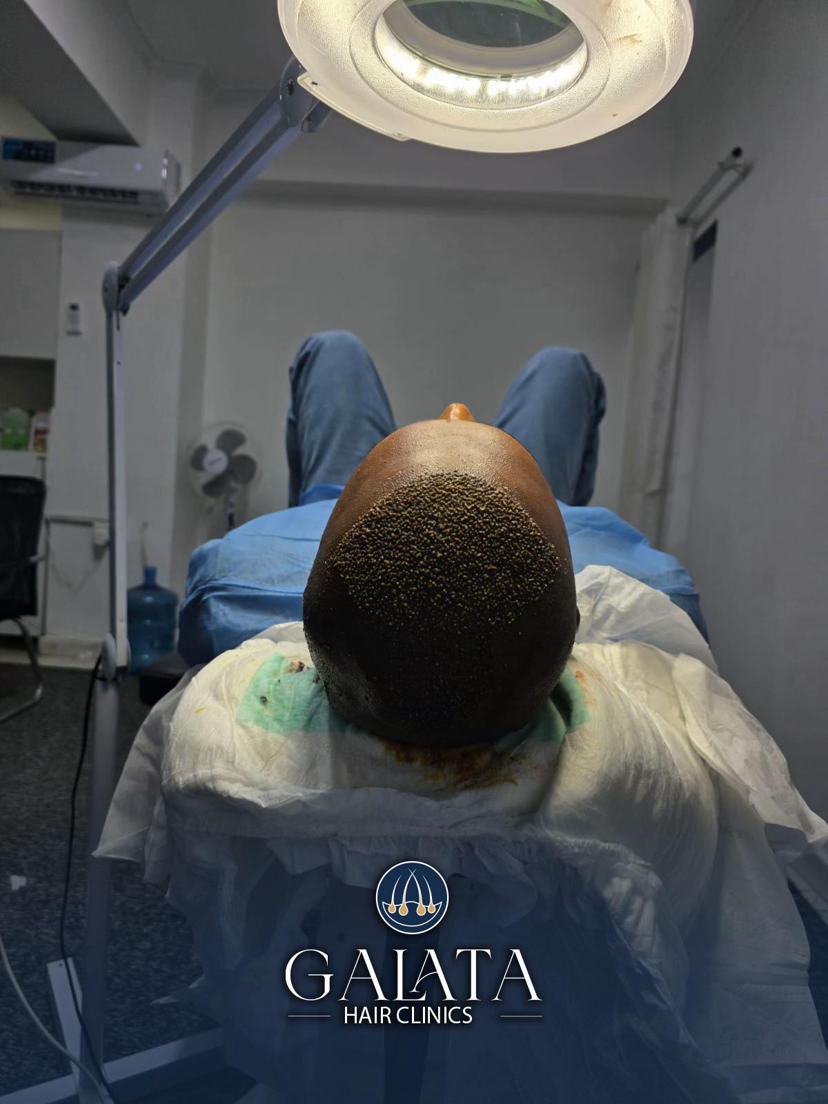 @galata_hair_clinic