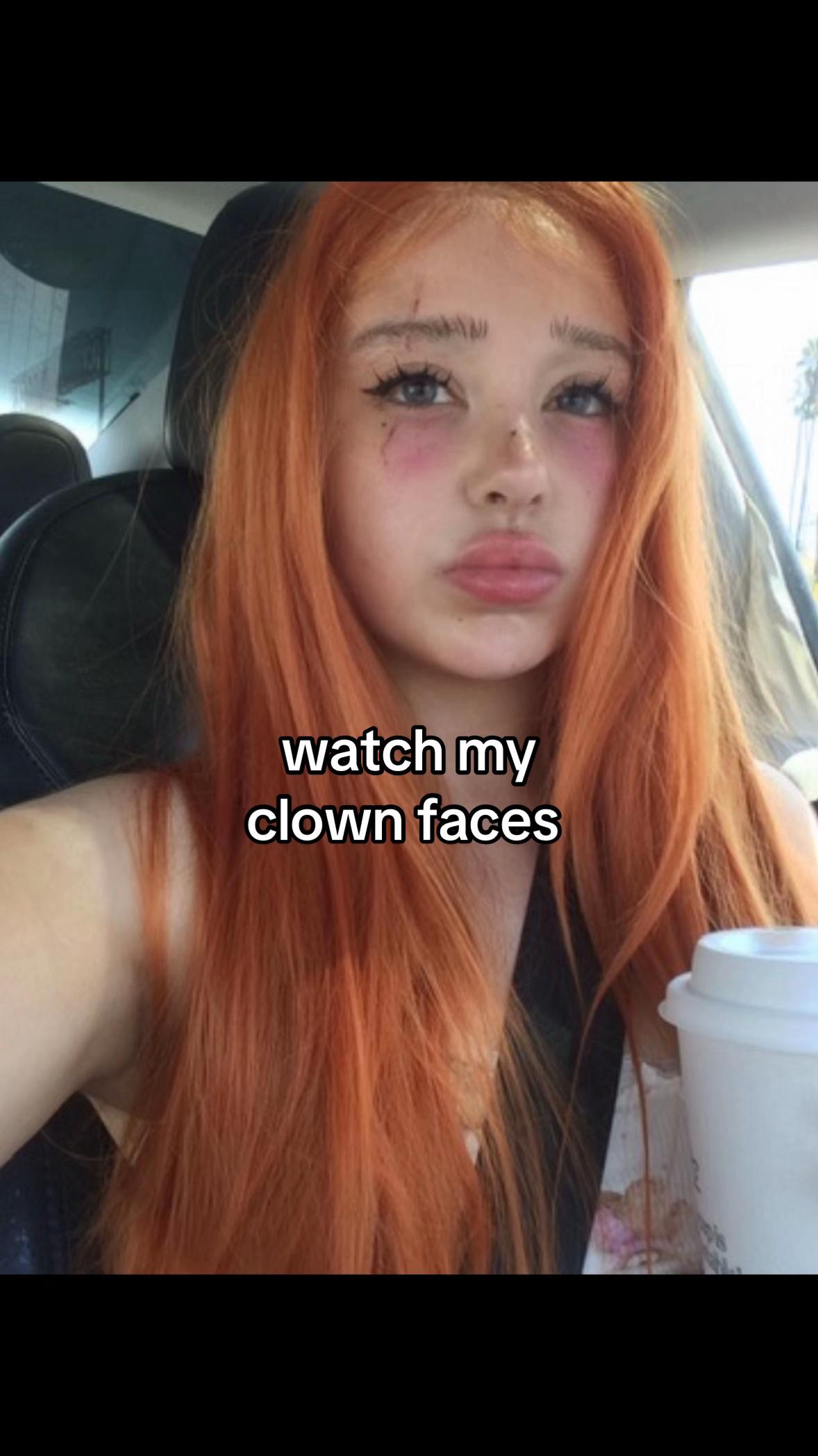 @Anoi