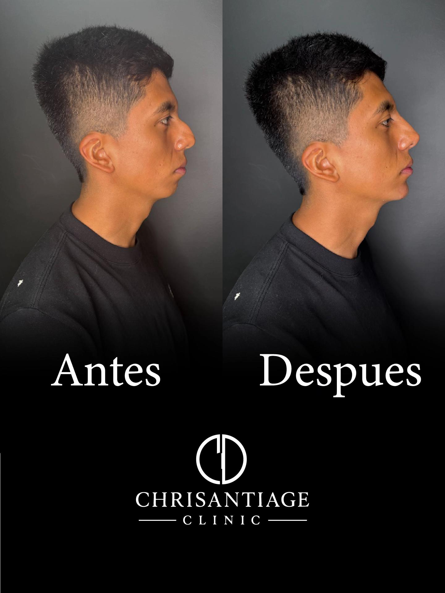 @chrisantiage
