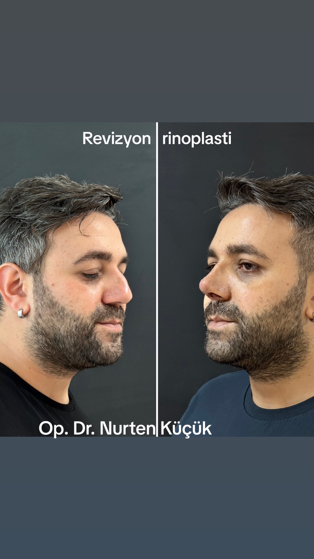@Dr. NurtenKucuk