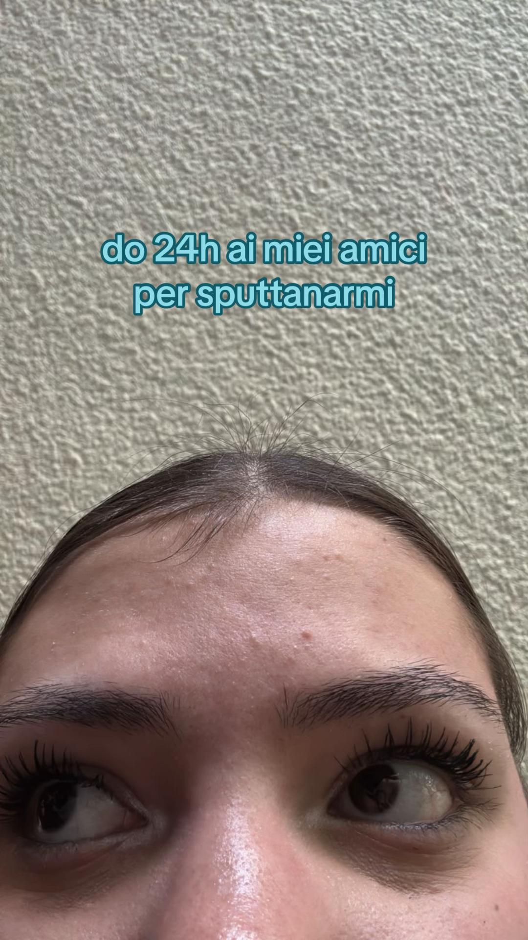 @𝟐𝟐