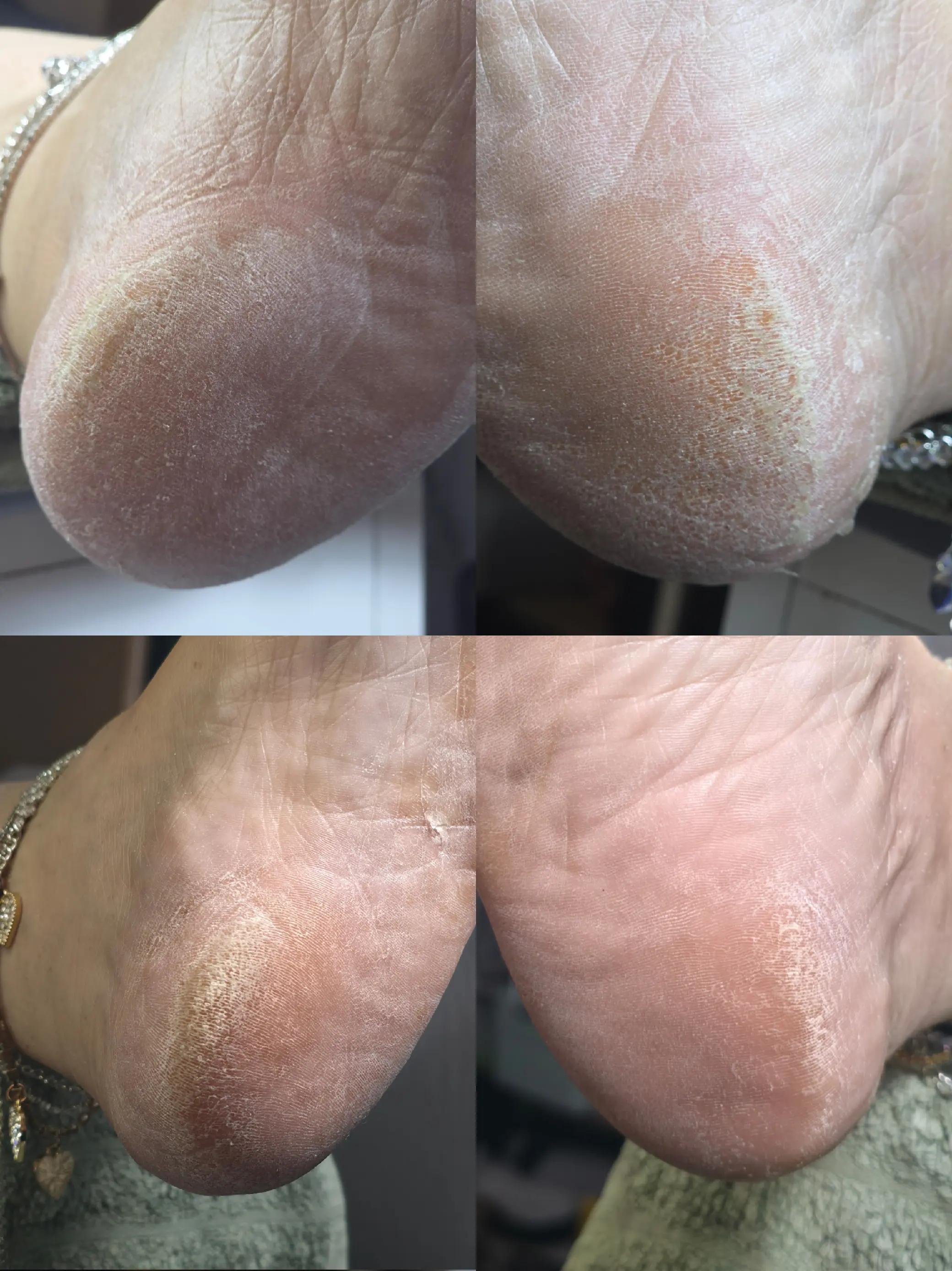 @PurelyNails