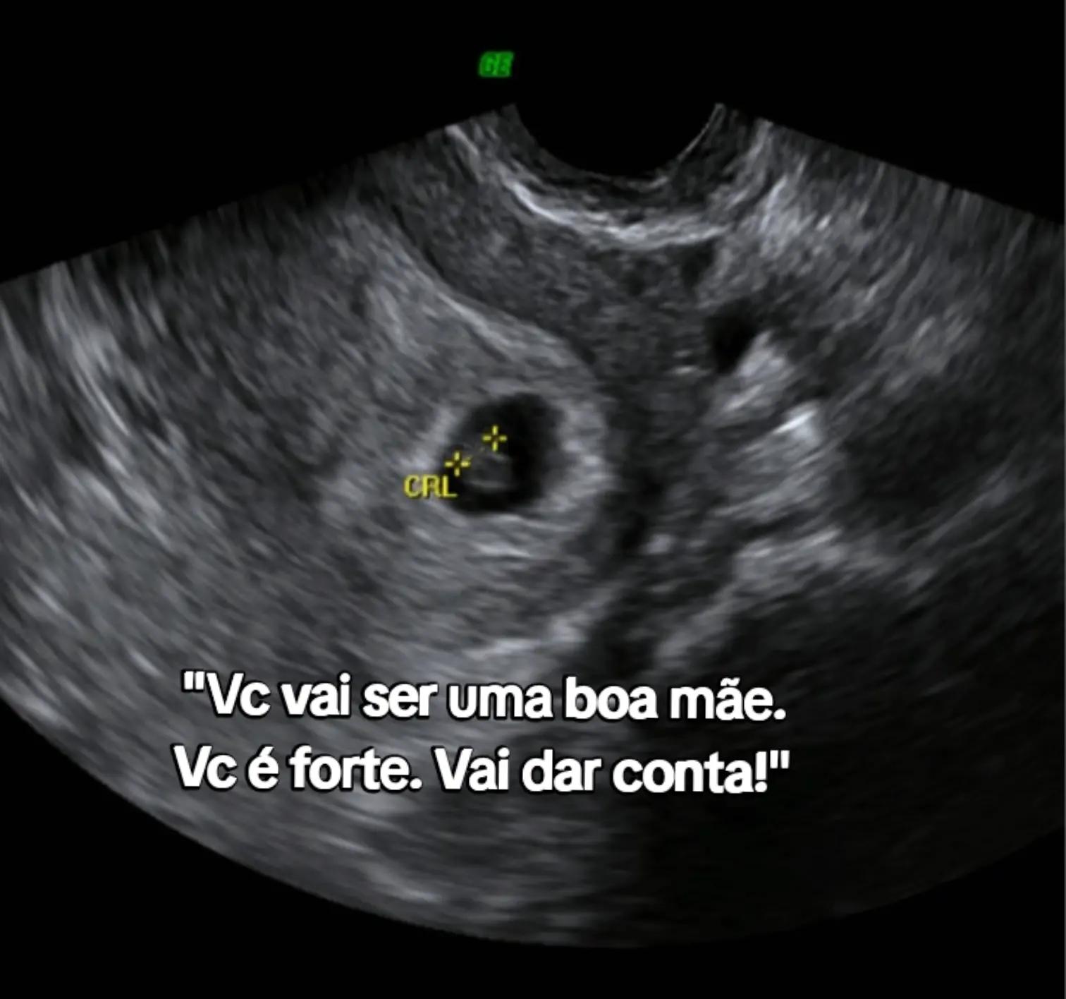 @Daiane Freitas