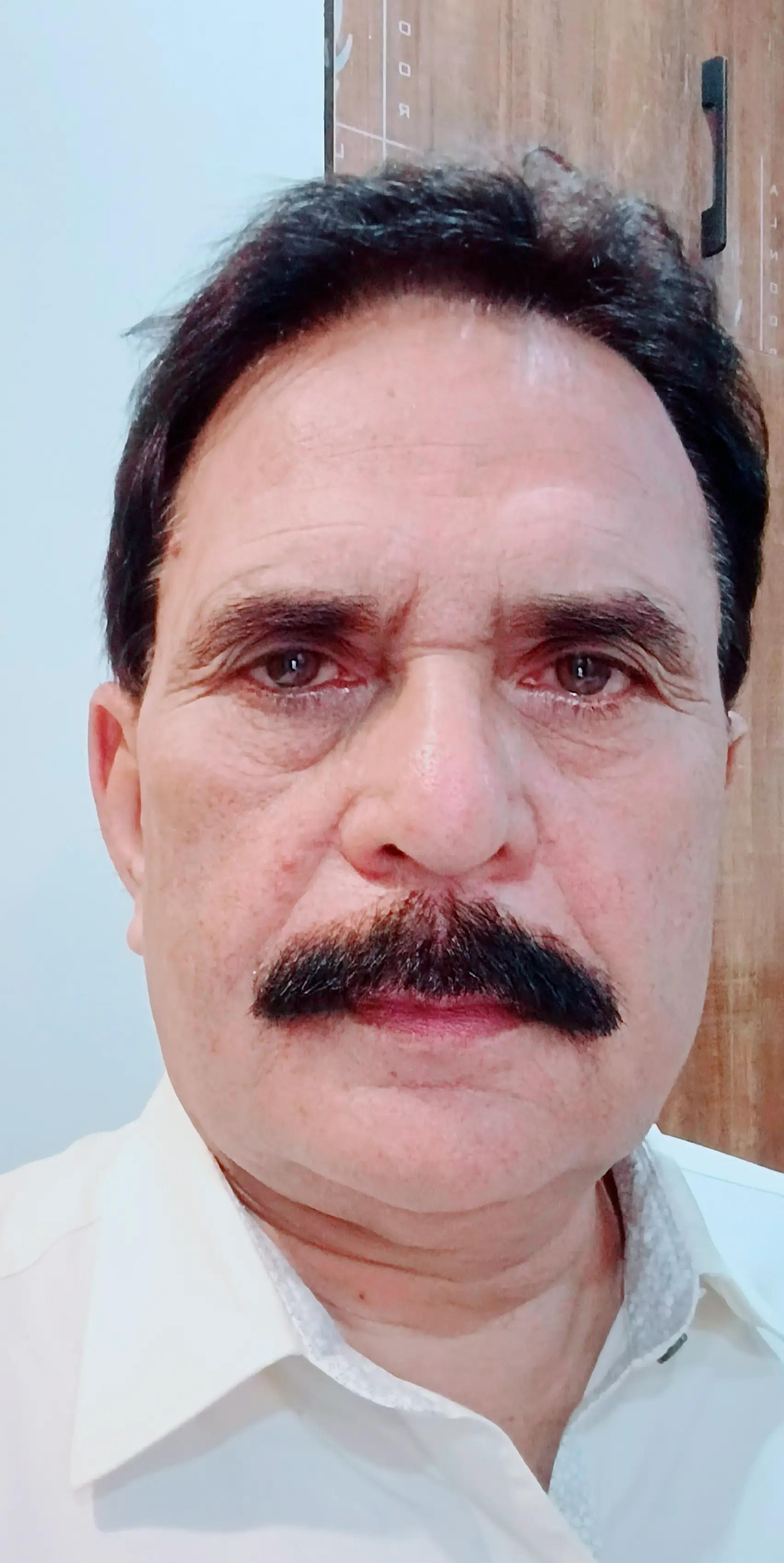 @Muhammad Ameen