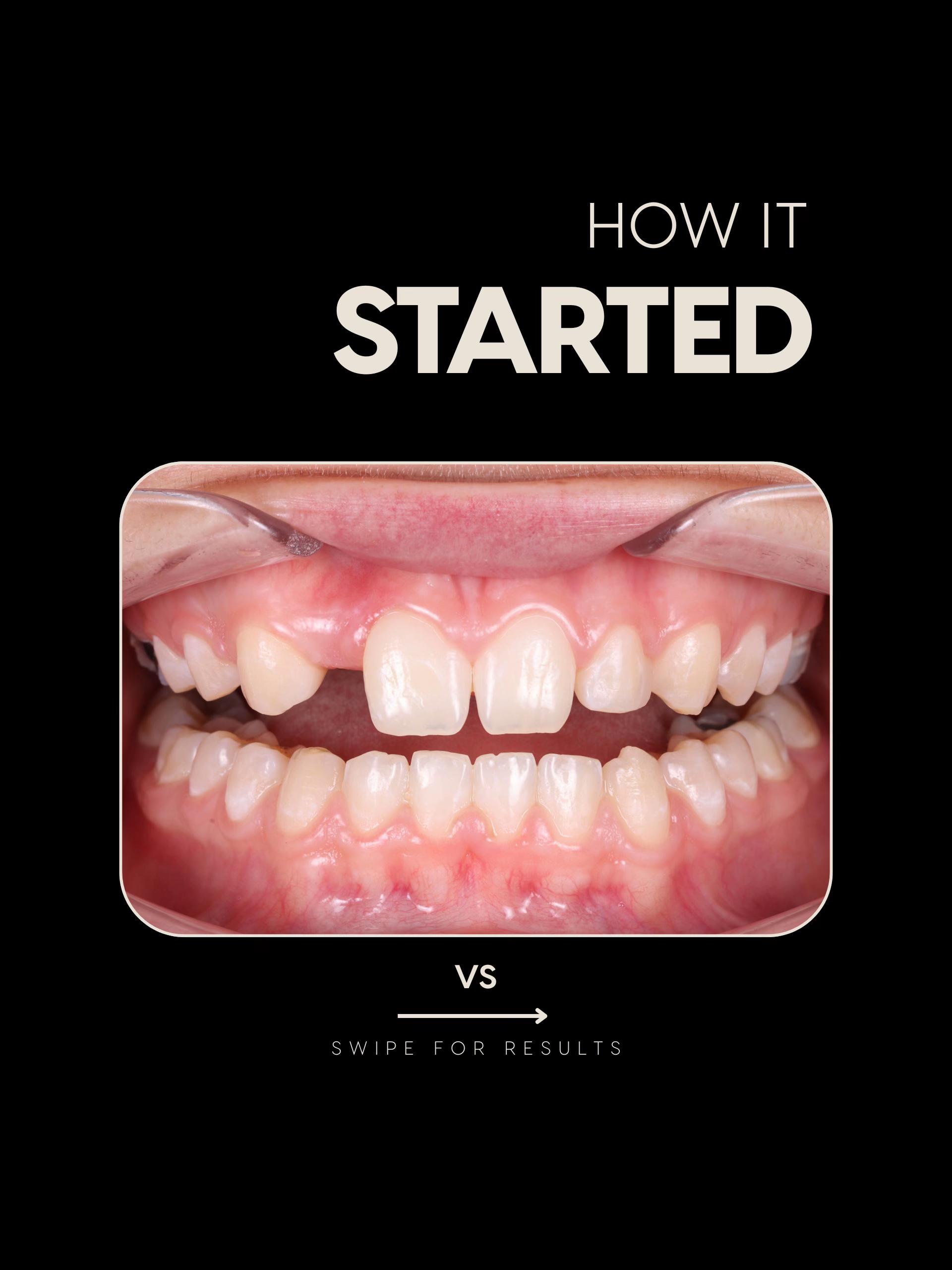 @Dentalexcellenceuk