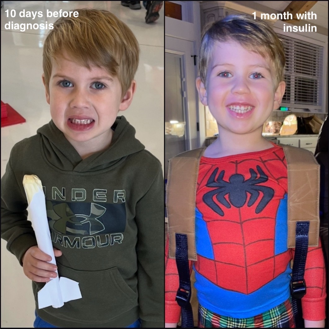 @Heather ||| T1D mom