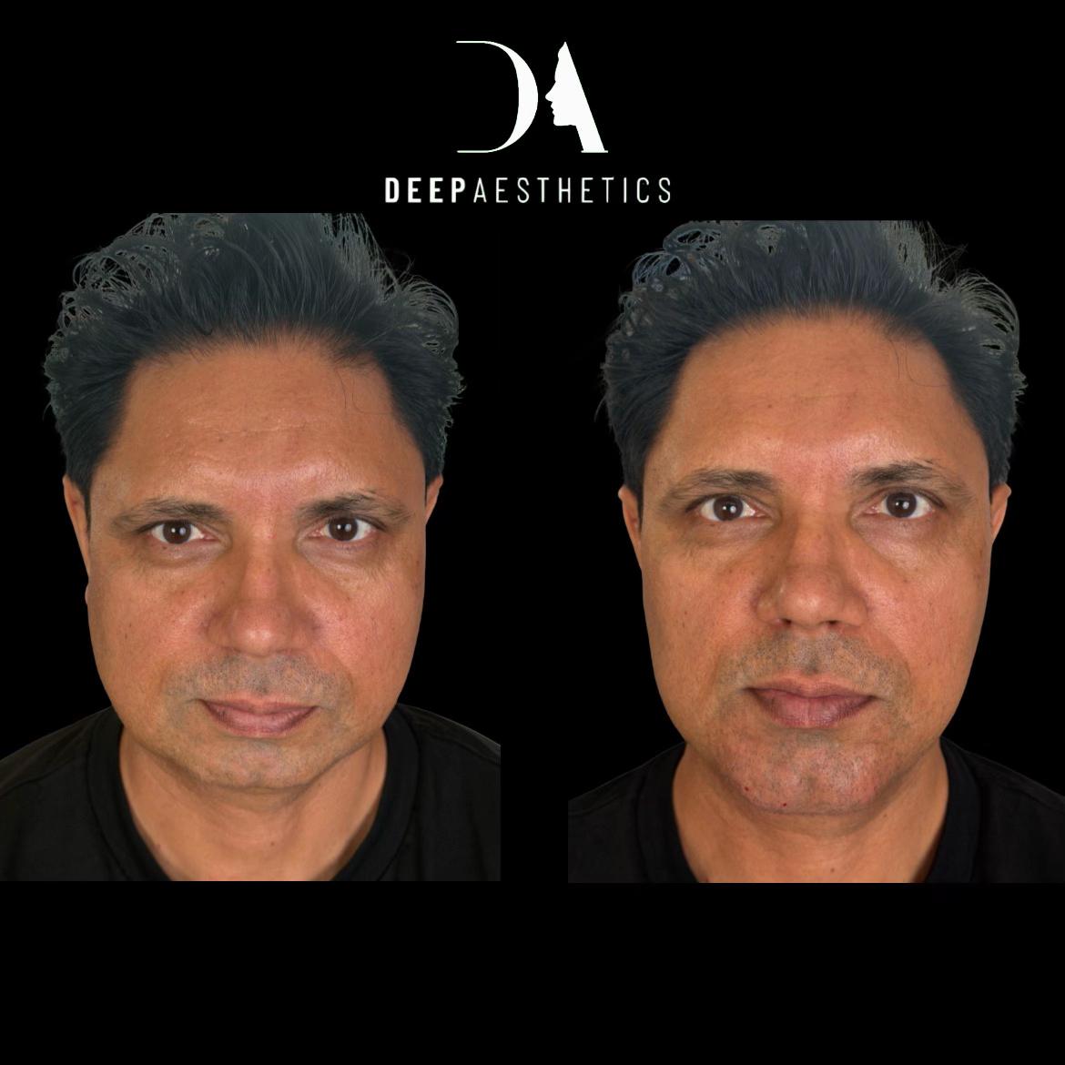 @deepaesthetics_official