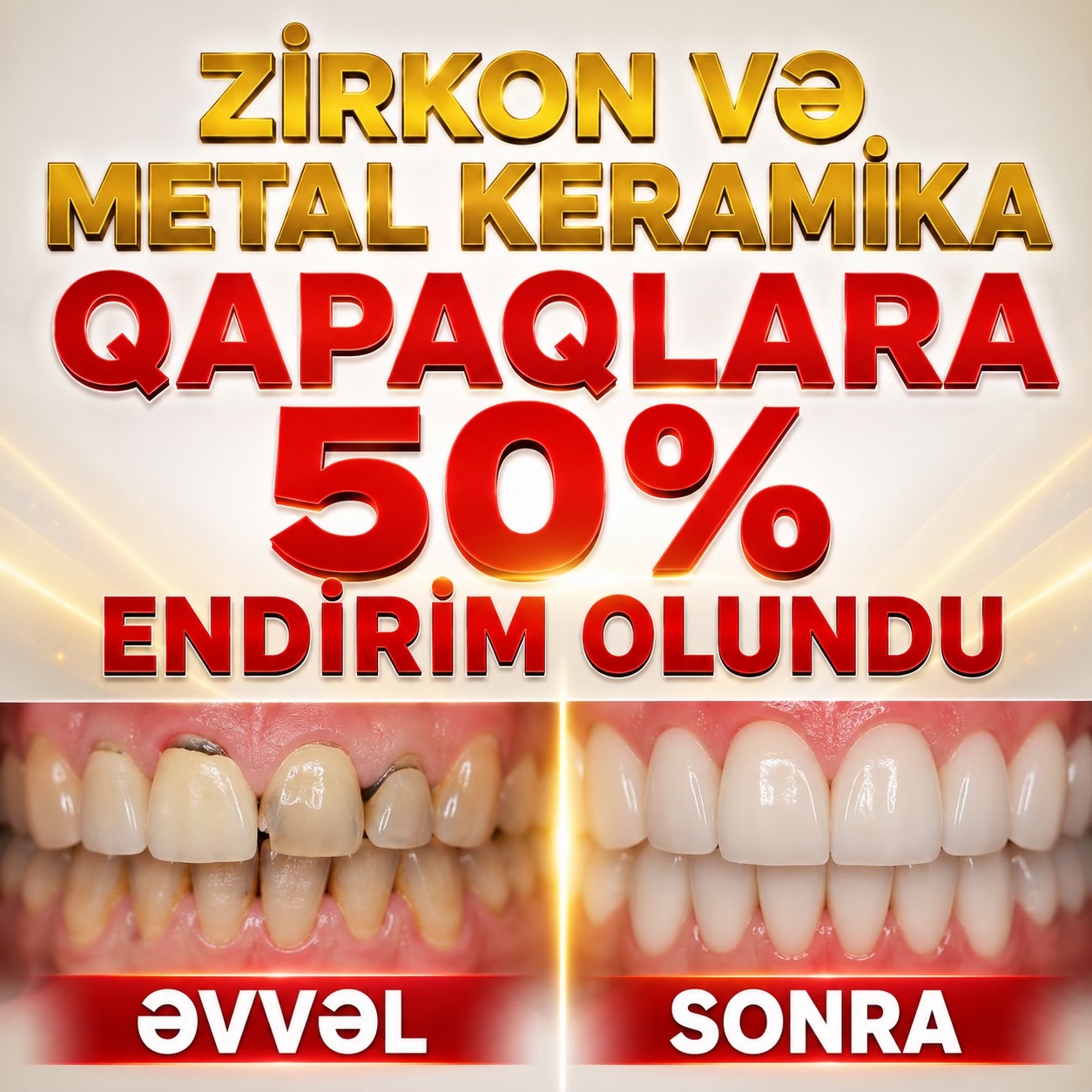@stomatoloq diş həkimi