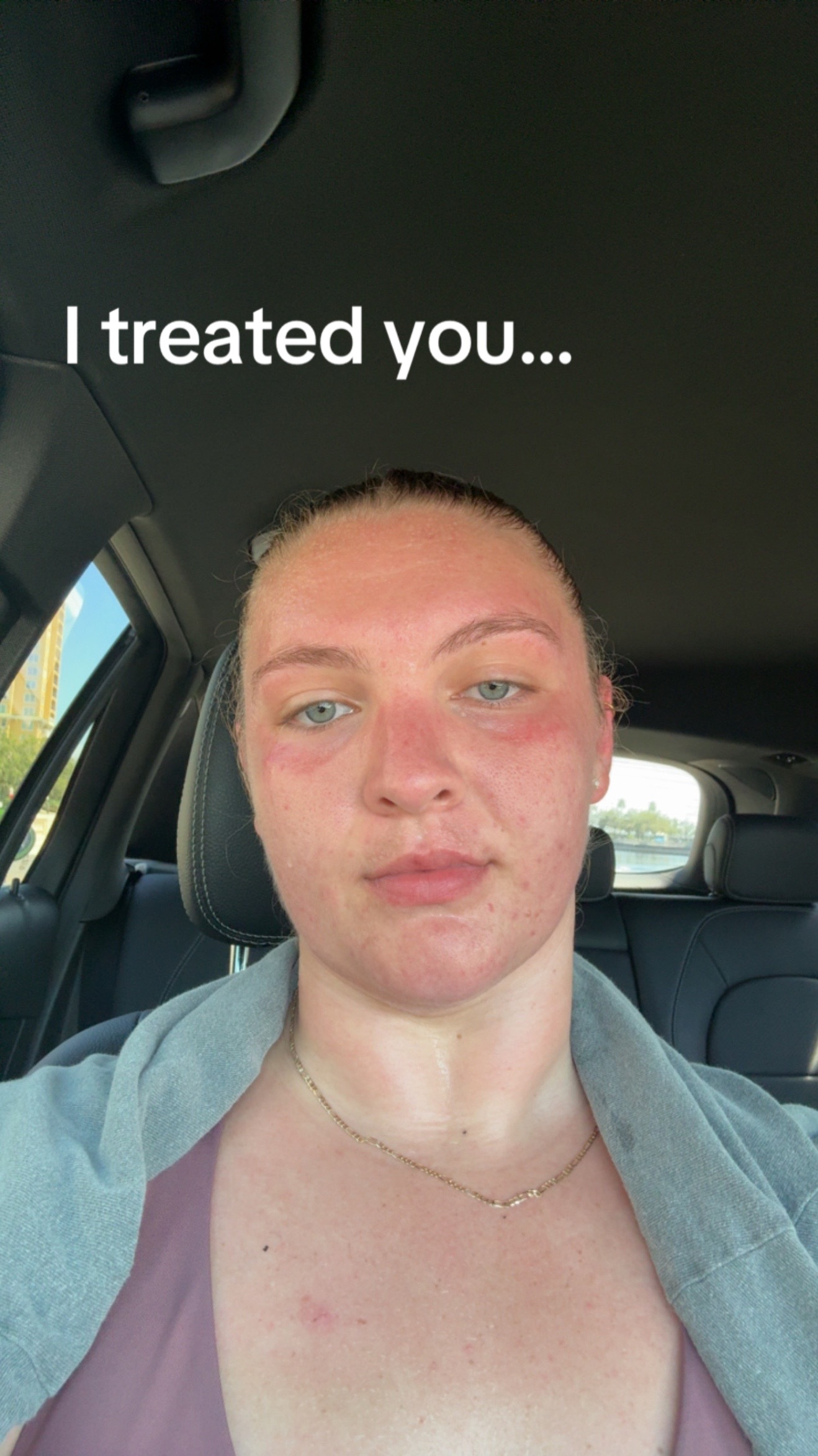 @Mandy