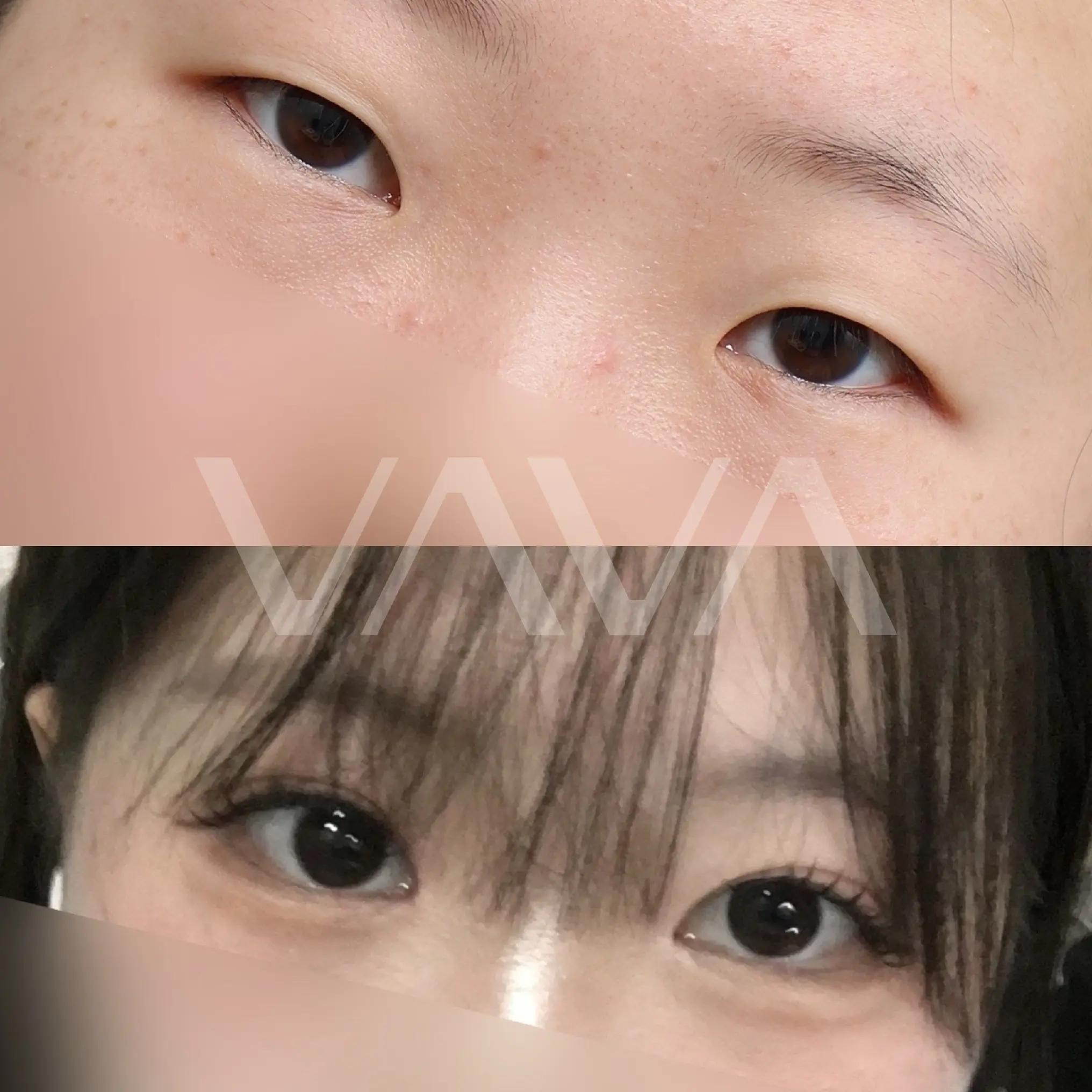 @VAVA美容整形外科