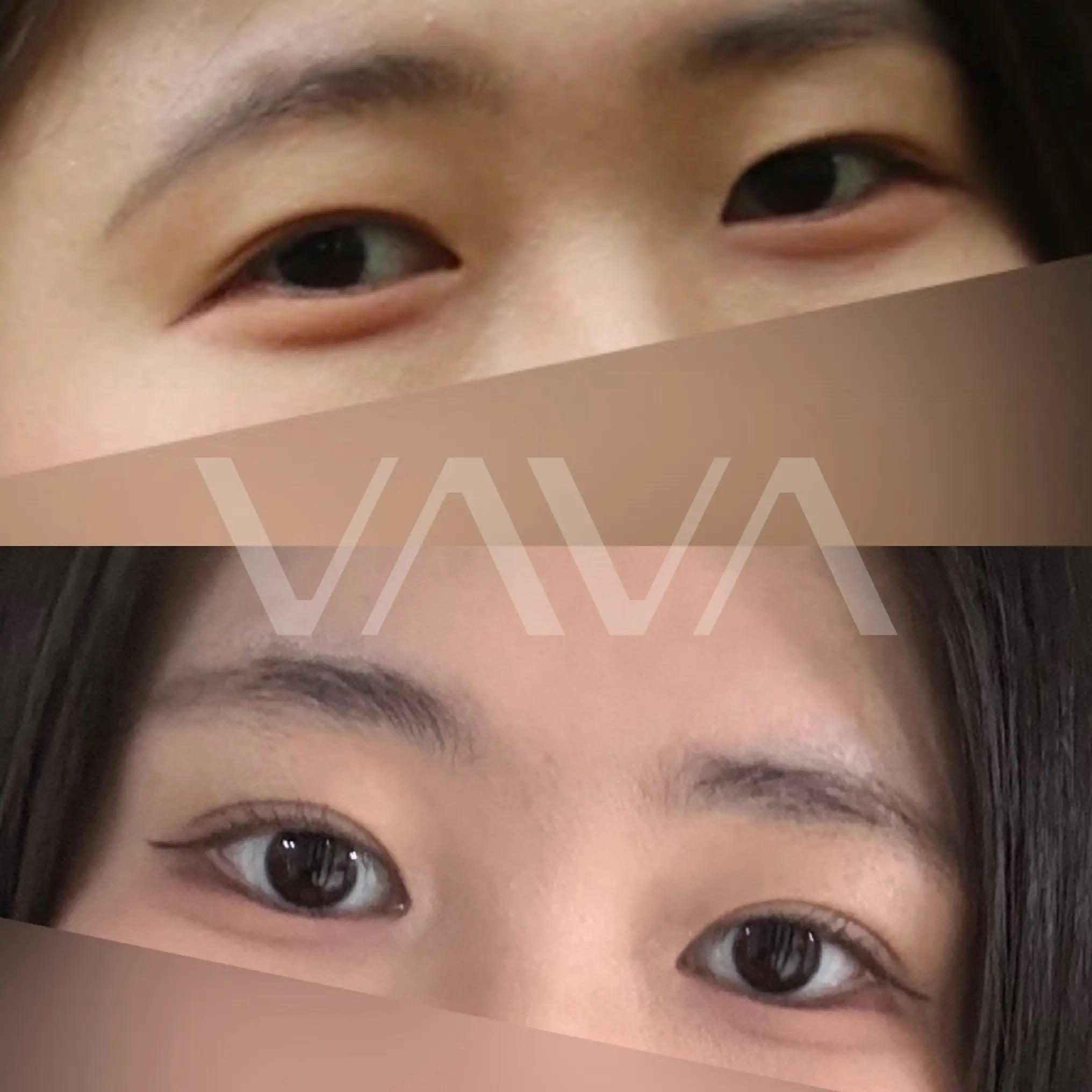 @VAVA美容整形外科