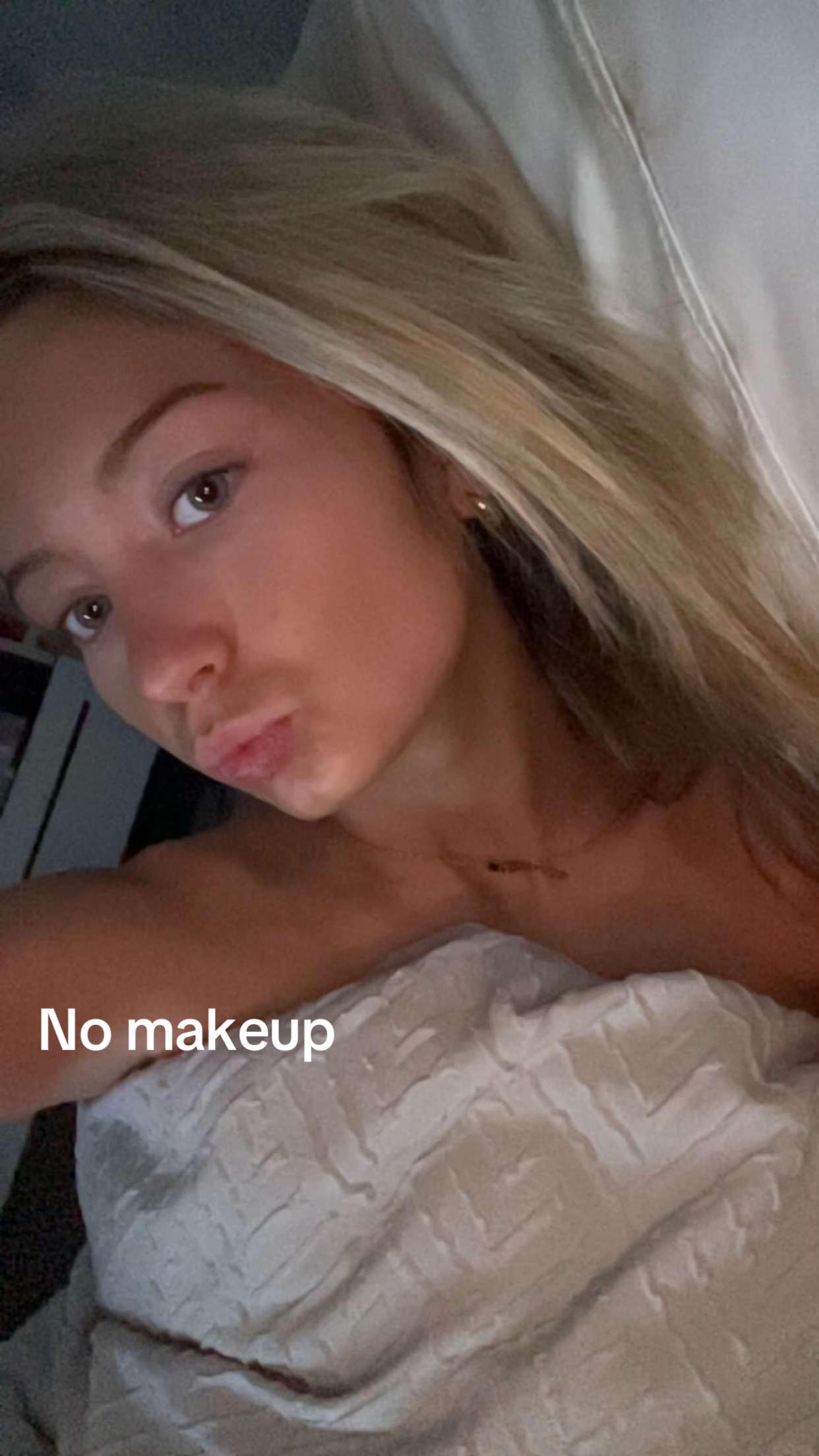 @𝐋