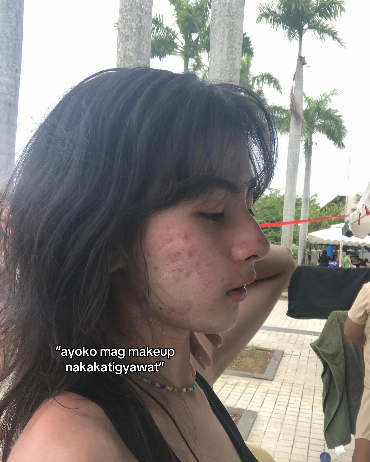 @Eywi 🍍 kindaeywi on IG