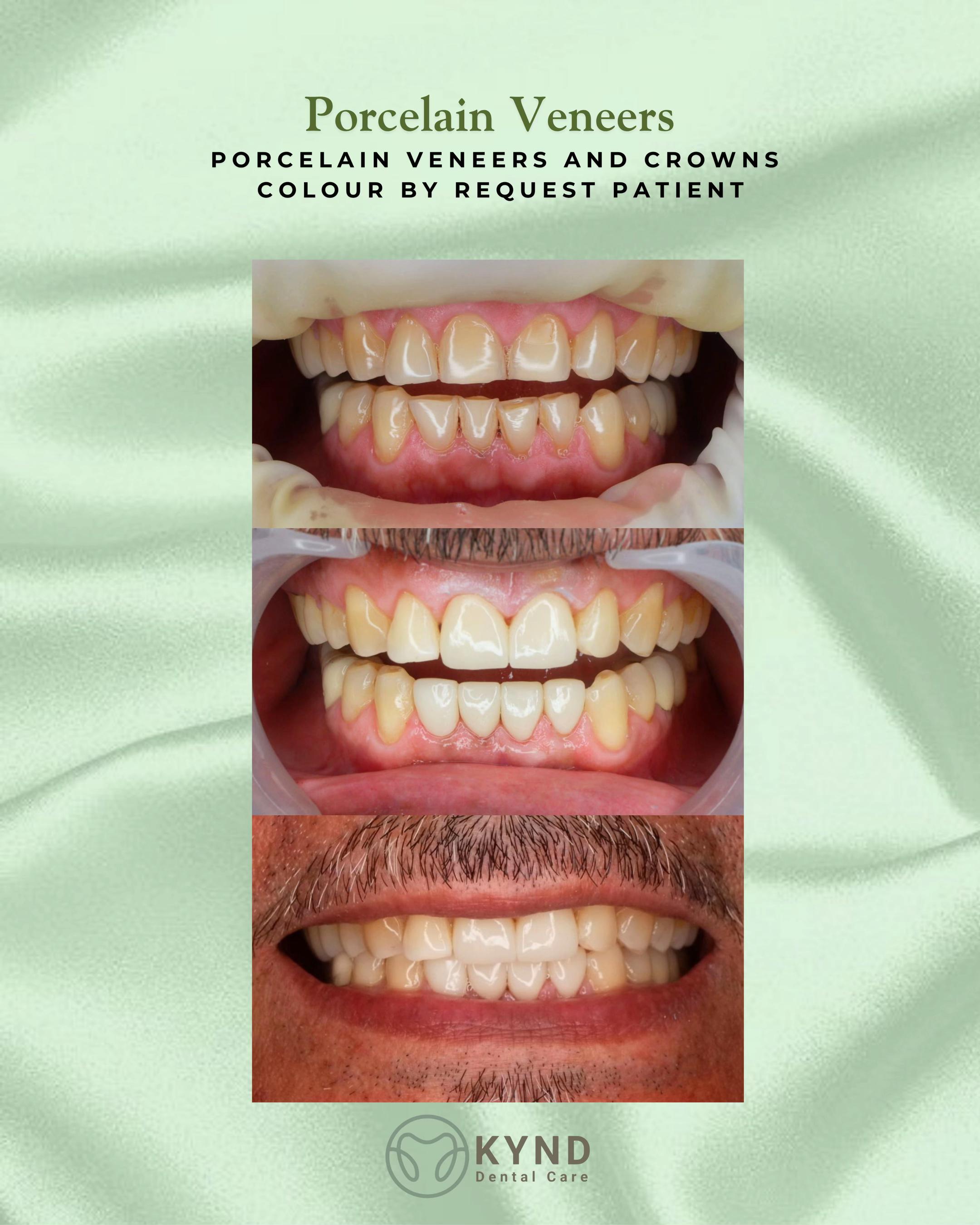 @KYND Dental Care |Dentist BALI