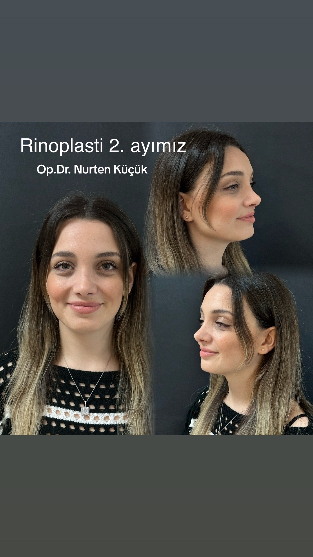 @Dr. NurtenKucuk