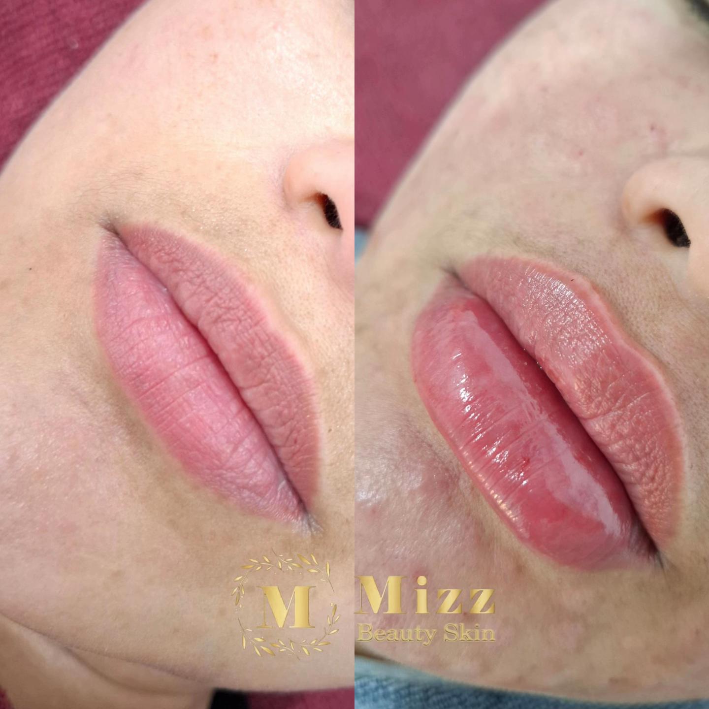 @mizzbeautyclinic